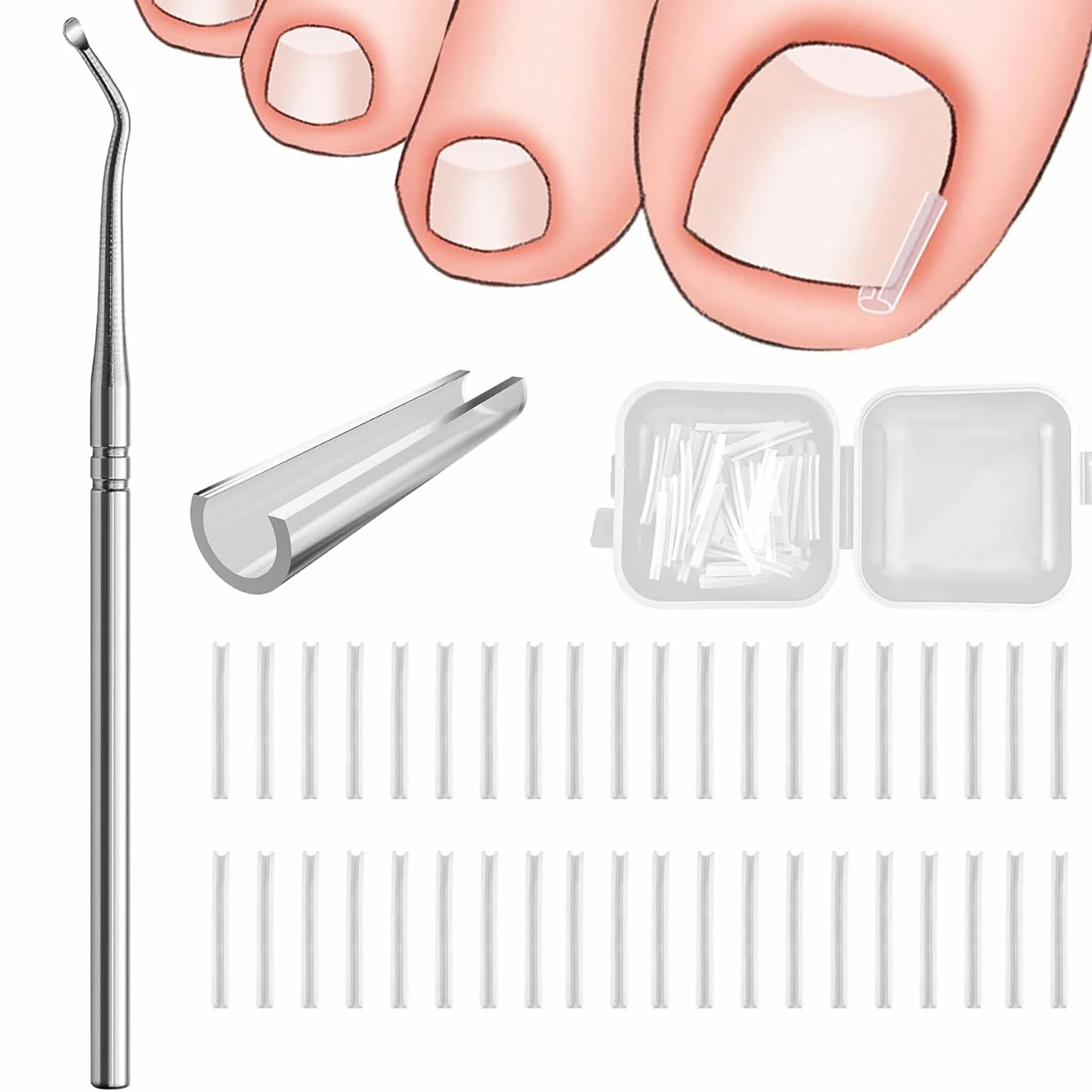 40 Pcs Unghie Incarnite Piedi Strisce Correttore Per Unghie Incarnite Unghie Piedi Incarnite Unghie Incarnite Piedi Unghie Incarnite Piedi Attrezzi Per Pedicure Con Sollevatore Per Unghie Incarnite