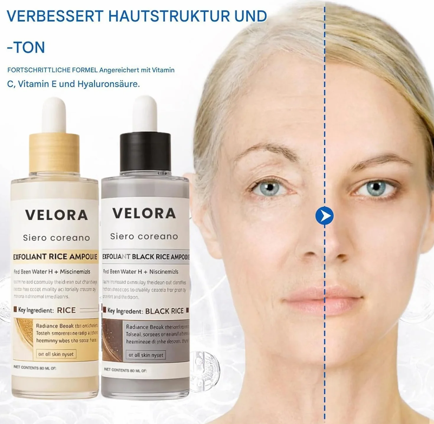 Velora Siero Coreano Esfoliante al Riso, 2026 Estratto Naturale, Ridurre i Pori e Idratare Profondamente per Tutti i Tipi di Pelle, 80ml*2 Pack
