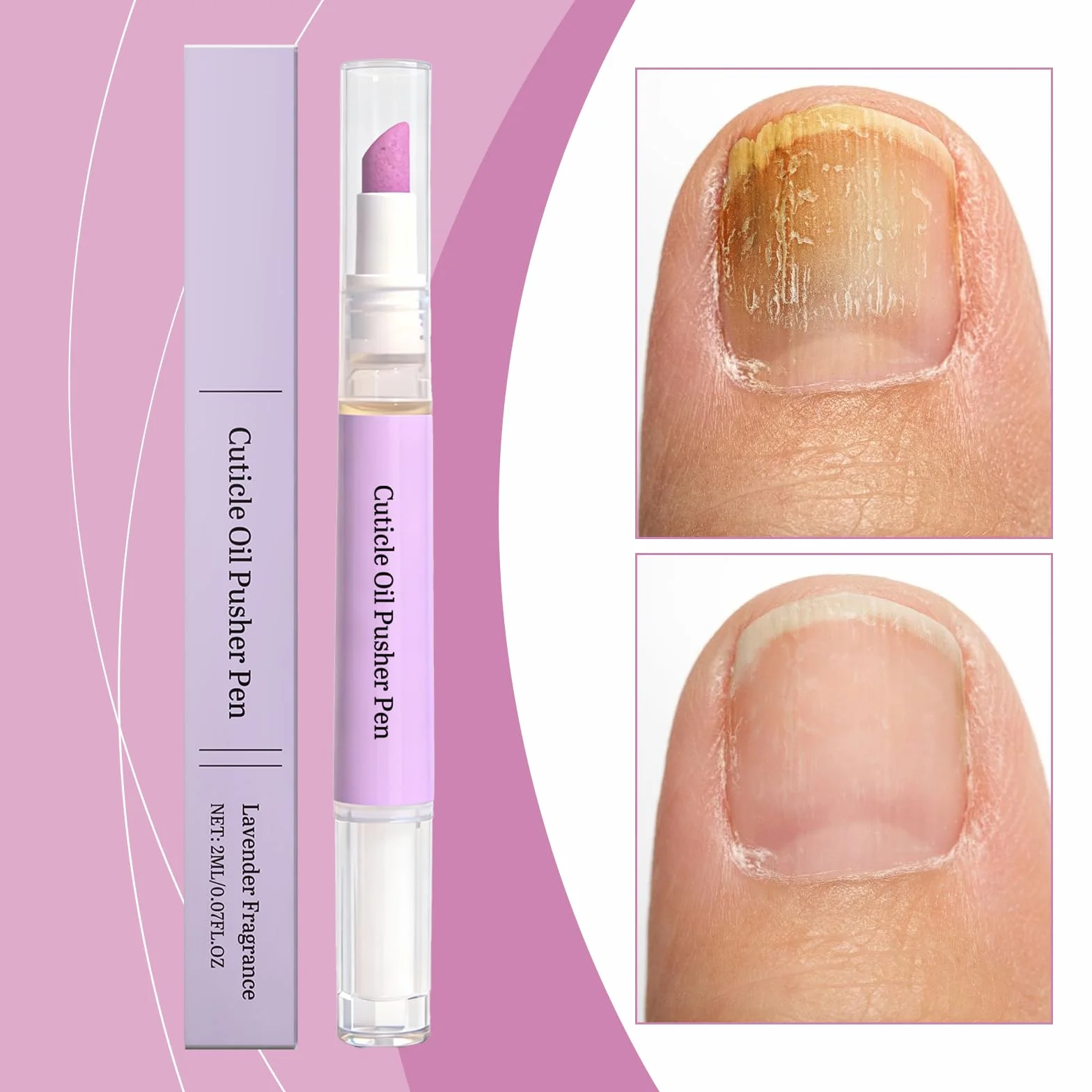 Rimuovi cuticole liquido, penna olio cuticole 2 in 1, penna spingi cuticole, Nail Care, penna a olio spingi cuticole, cura per la riparazione delle unghie secche e danneggiate (1 pezzo)