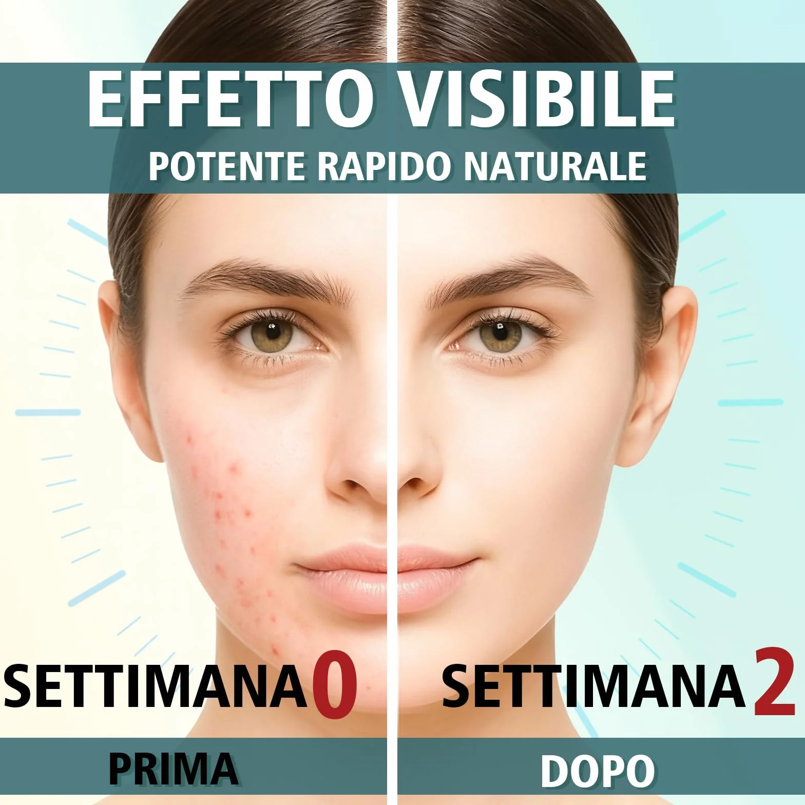 Crema Brufoli Viso, Crema Acne Potentissima, Cura per Brufoli e Imperfezioni, Riduce Subito Acne e Brufoli, Punti Neri e Rossori, Adatta a Tutti i Tipi di Pelle e Età,per la Pelle di Viso e Corpo