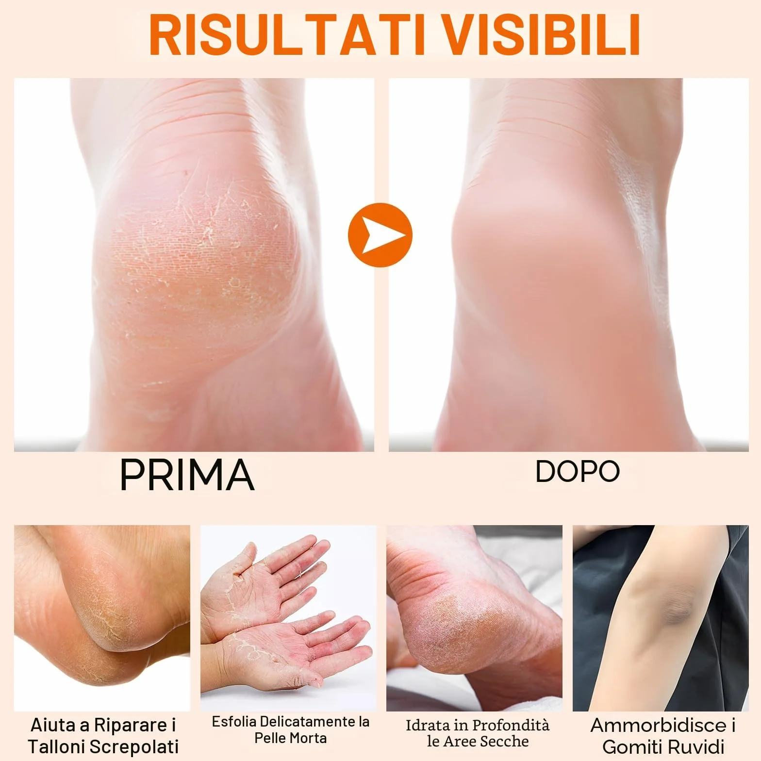 Crema Manuka per Talloni e Gomiti Idratante Esfoliante 40g