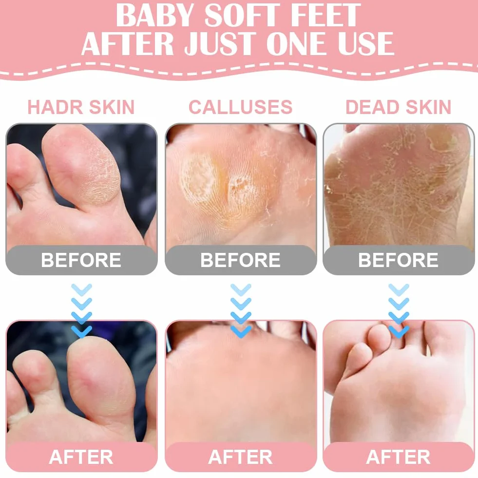 Maschera Piedi Idratante, 4 Paia Maschera Piedi ad Azione Idratante e Rigenerante, Calzini Idratanti per Riparazioni Cutanee Secche Invecchiamento Cracked Heels, per Piedi Lisci e Morbidi