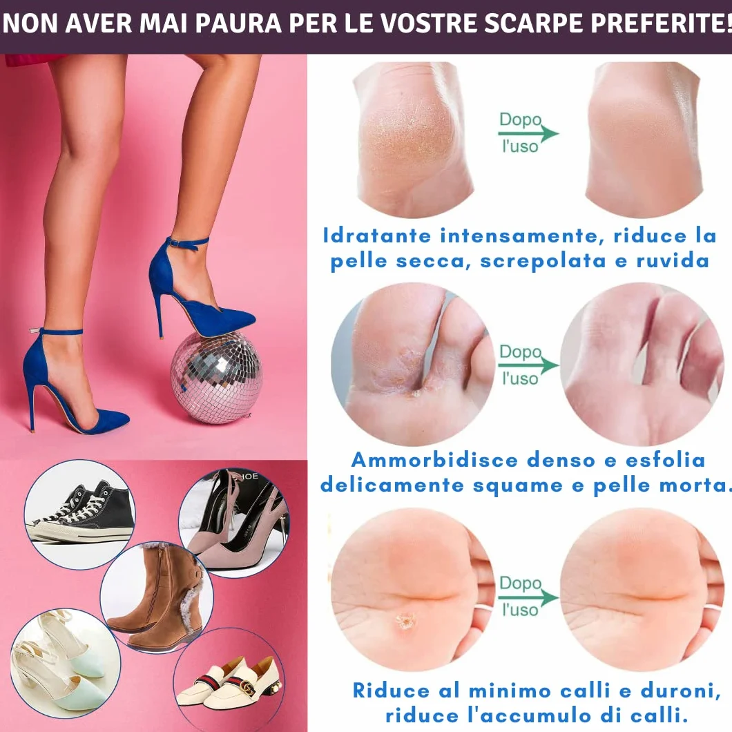 Crema Urea 30% 100ml per Eczemi Psoriasi Cheratosi Dermatite Talloni Screpolati Calli
