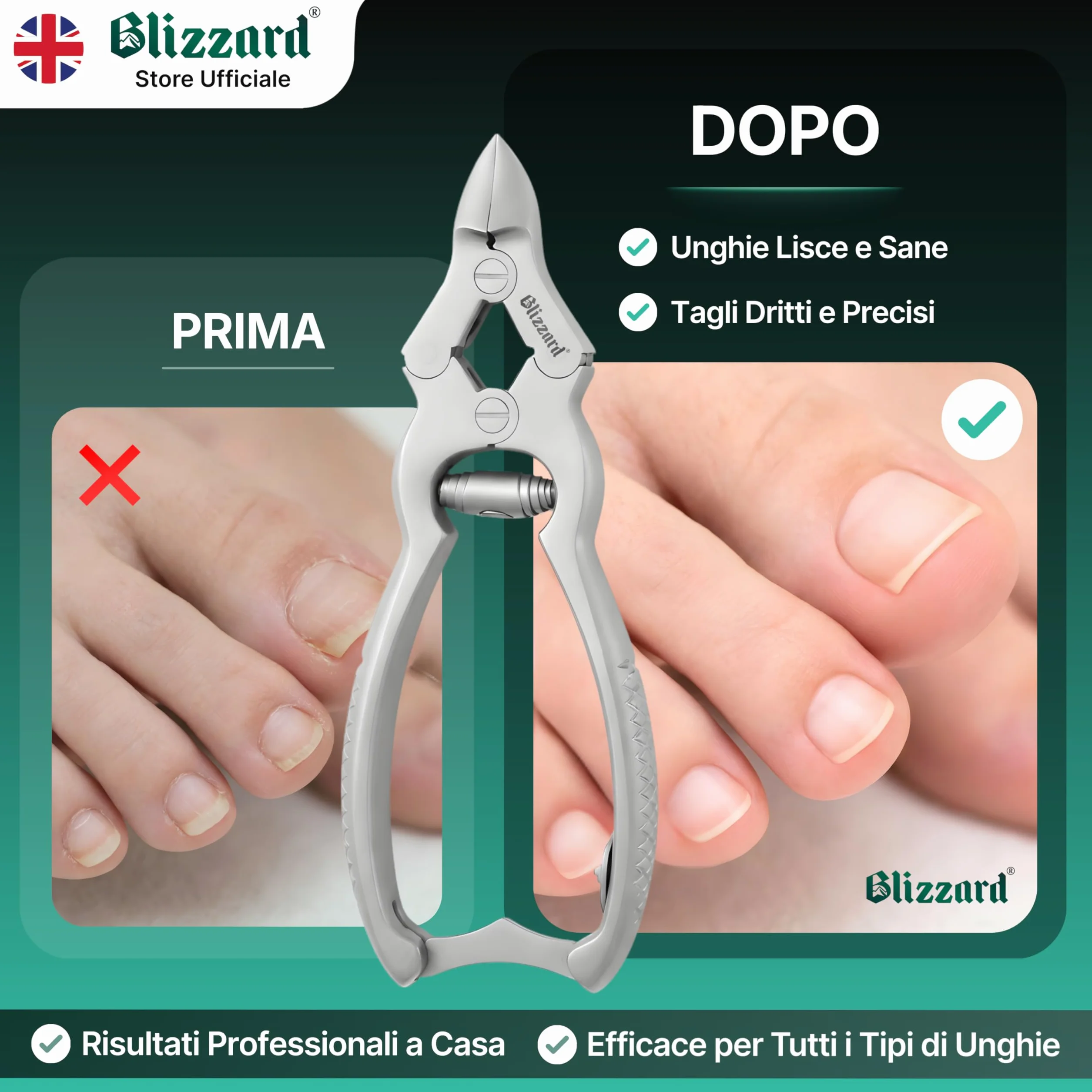 Blizzard Tronchese Unghie Piedi Professionale in Acciaio Inox 15cm Molla a Barilotto