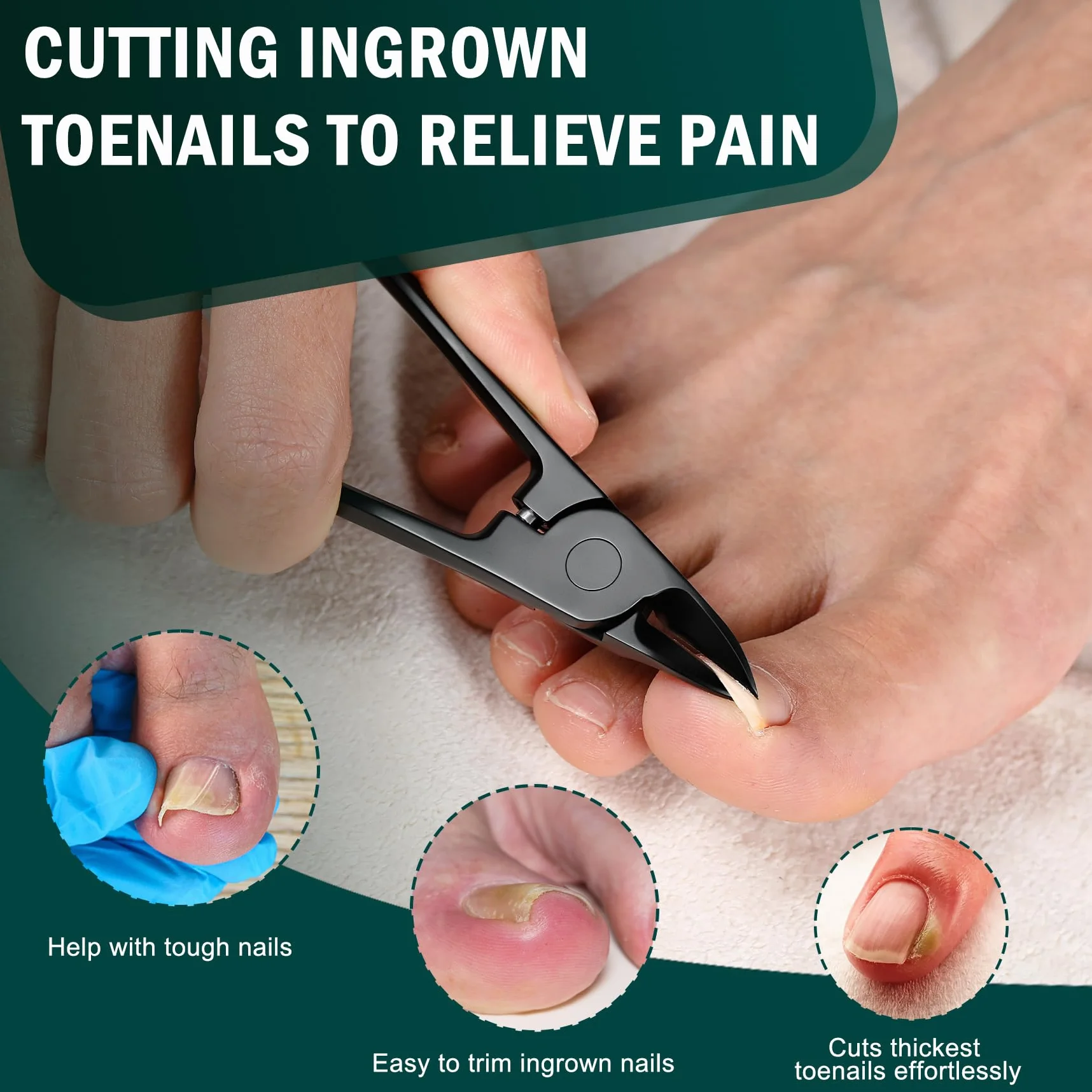 FVION Precisione Tronchesino Unghie Piedi Professionale, Tronchese Per Unghie Spesse Incarnite in Acciaio Tagliaunghie Manicure e Pedicure