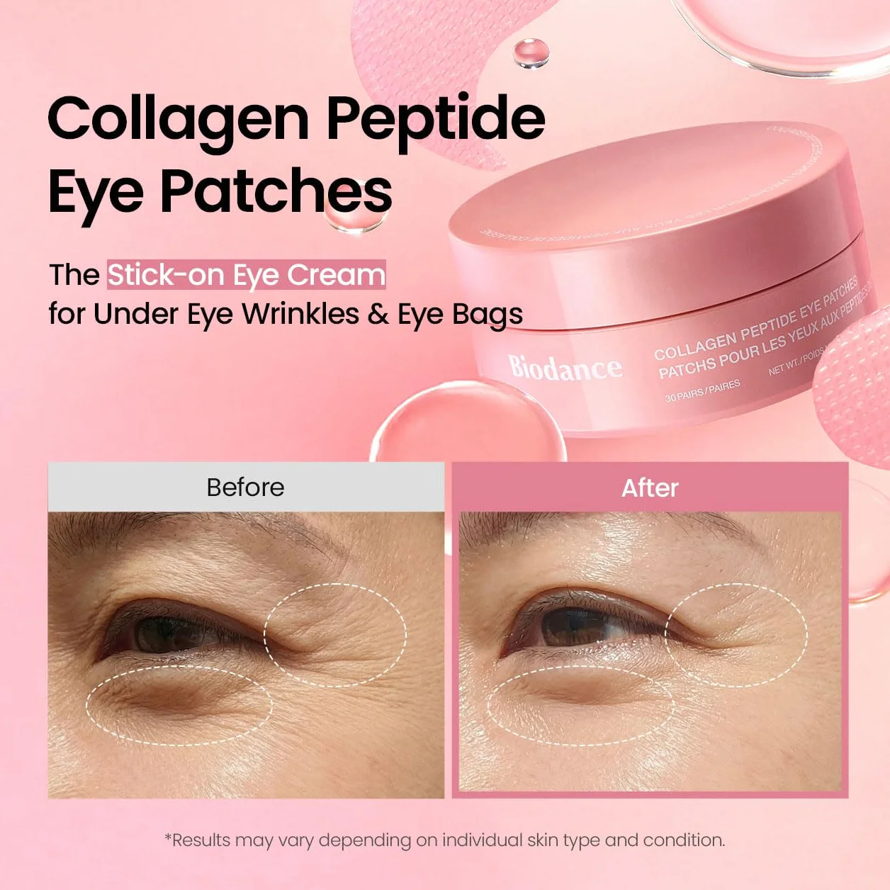 BIODANCE Patch Occhi al Collagene e Peptidi, Trattamento Antirughe per Contorno Occhi e Linee del Sorriso, Maschera Occhi per Linee Sottili e Borse, Skincare Coreana (60 pezzi)
