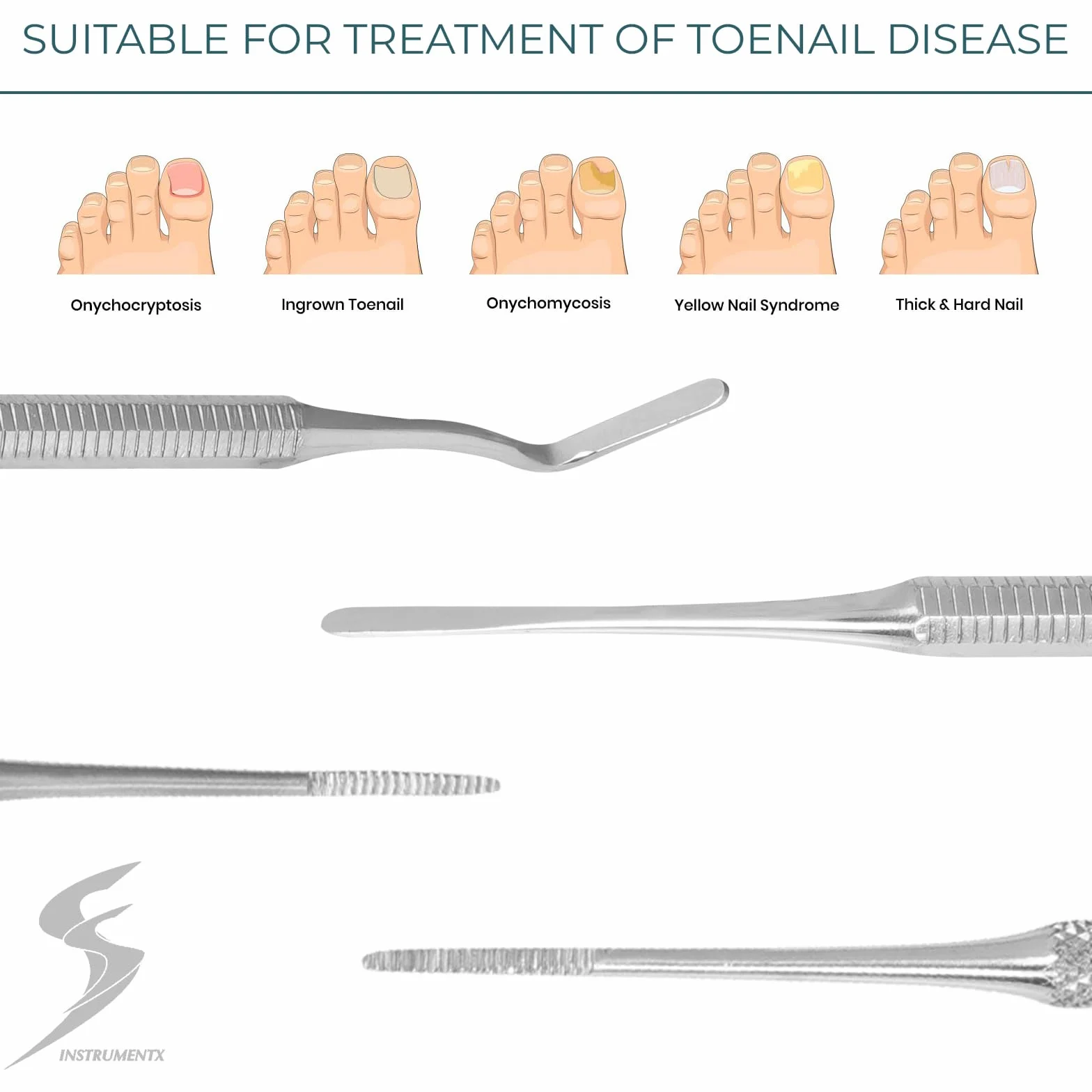 SS INSTRUMENTX Kit lime e sollevatore per unghie dei piedi a doppia estremità BORDI LATERALI INCARNITI Podologia Podologia SS