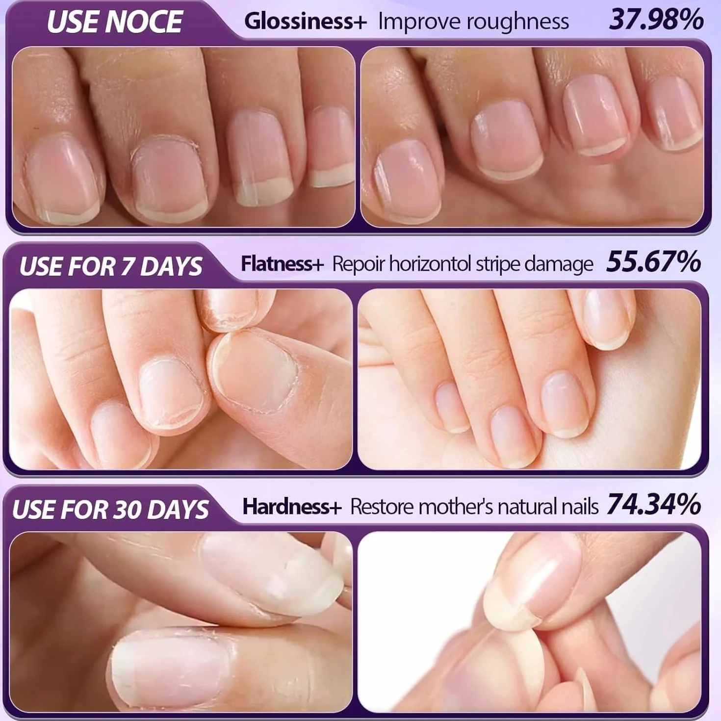 Spingicuticole 2.0, 2 in 1, penna per olio cuticole, punta in ceramica, cura per la riparazione di unghie secche, peeling delicato e cura del letto ungueale (8 pezzi)