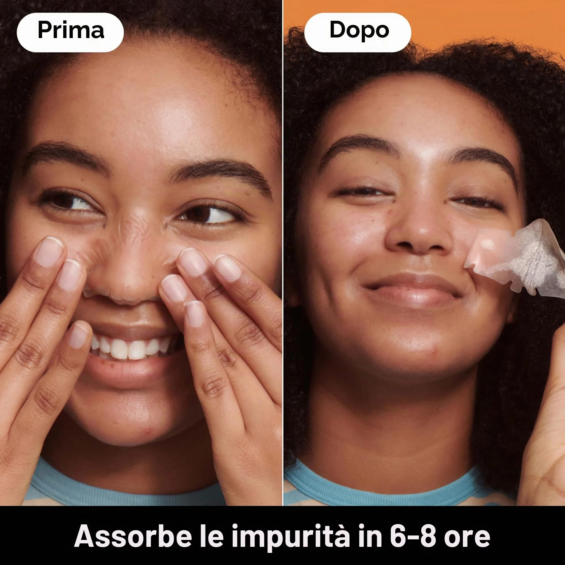 Hero Mighty Patch Nose: Cerotto anti-acne all'idrocolloide che assorbe le impurità dai pori e dai brufoli sul naso in 6 ore, confezione da 10 cerotti.