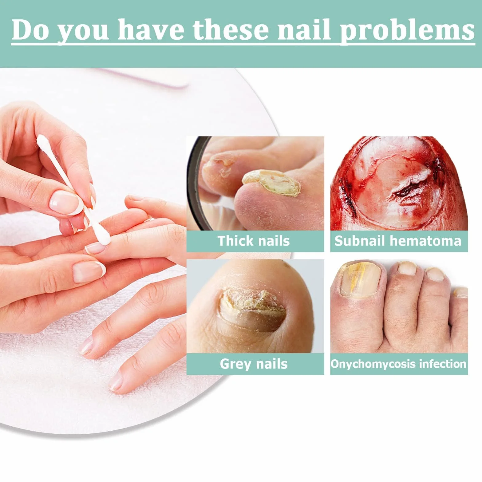 Anti Fungal Pen