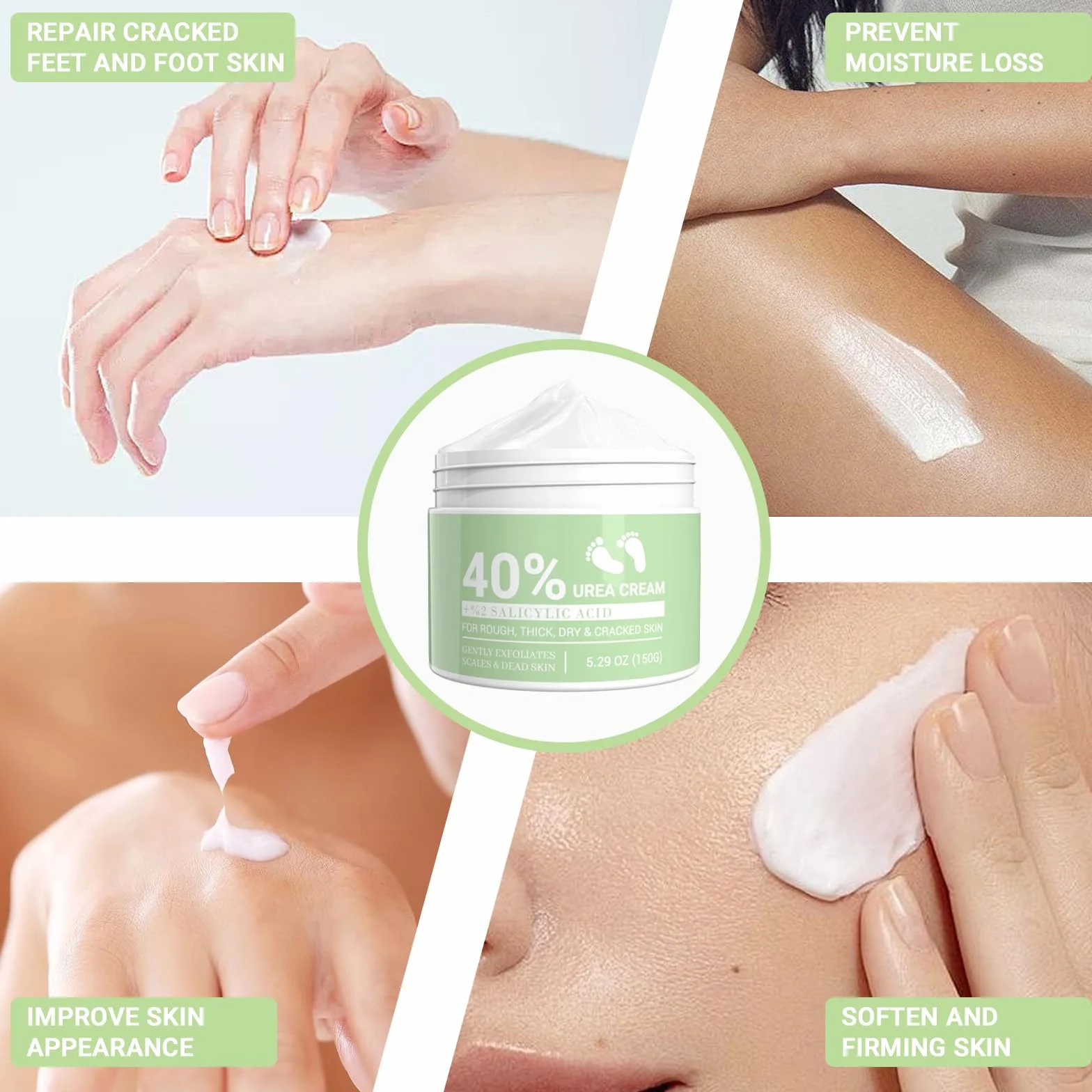 Crema Urea 40% con Acido Salicilico 2% e Aloe Vera per Piedi Secchi Sscrepolati