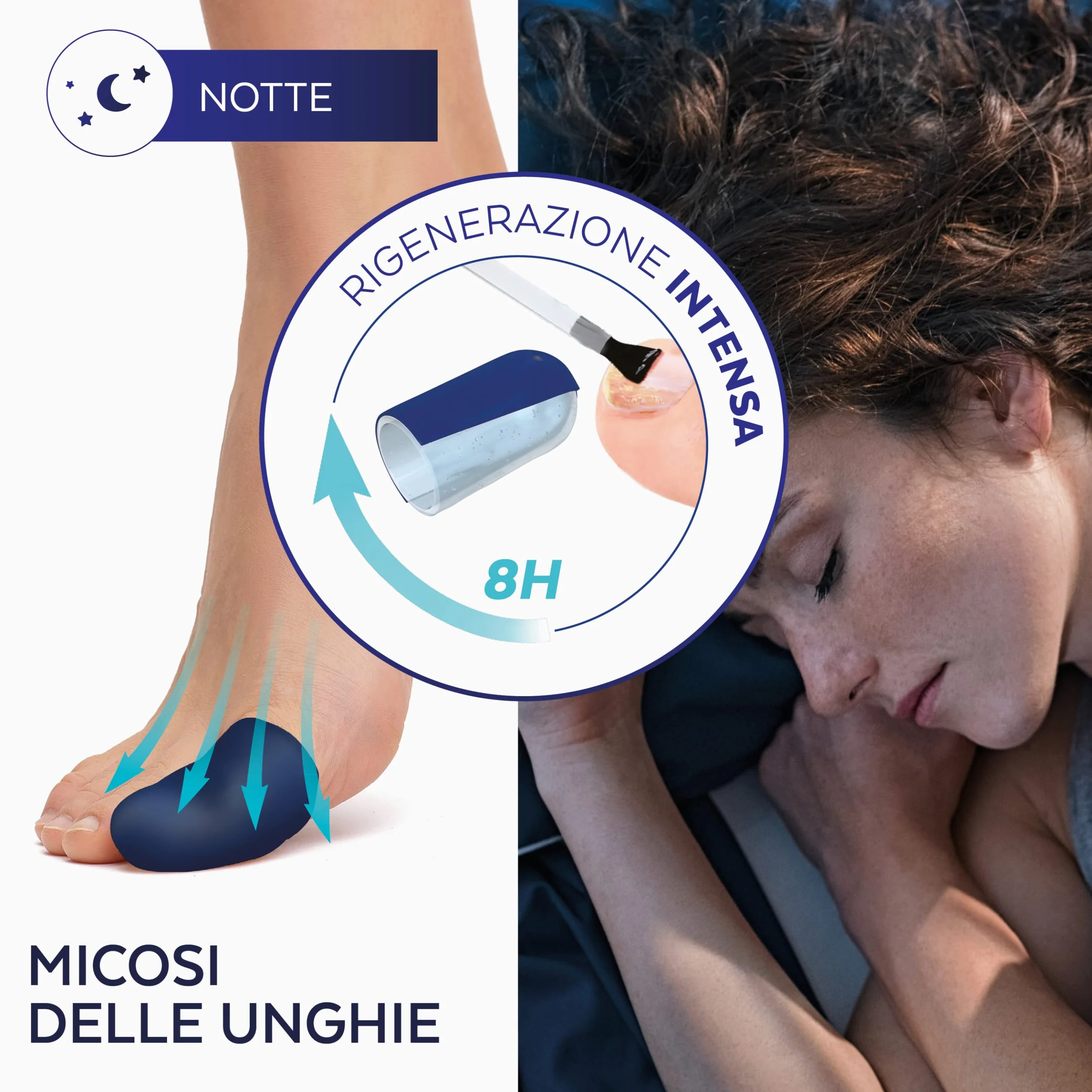 PODERM – MICOSI UNGHIE PIEDE TRATTAMENTO INTENSIVO NOTTE 2 in 1 – Elimina la micosi e rinnova l'unghia durante il sonno | VEGAN | Trattamento professionale piedi/mani | Facile e rapido | SWISS MADE