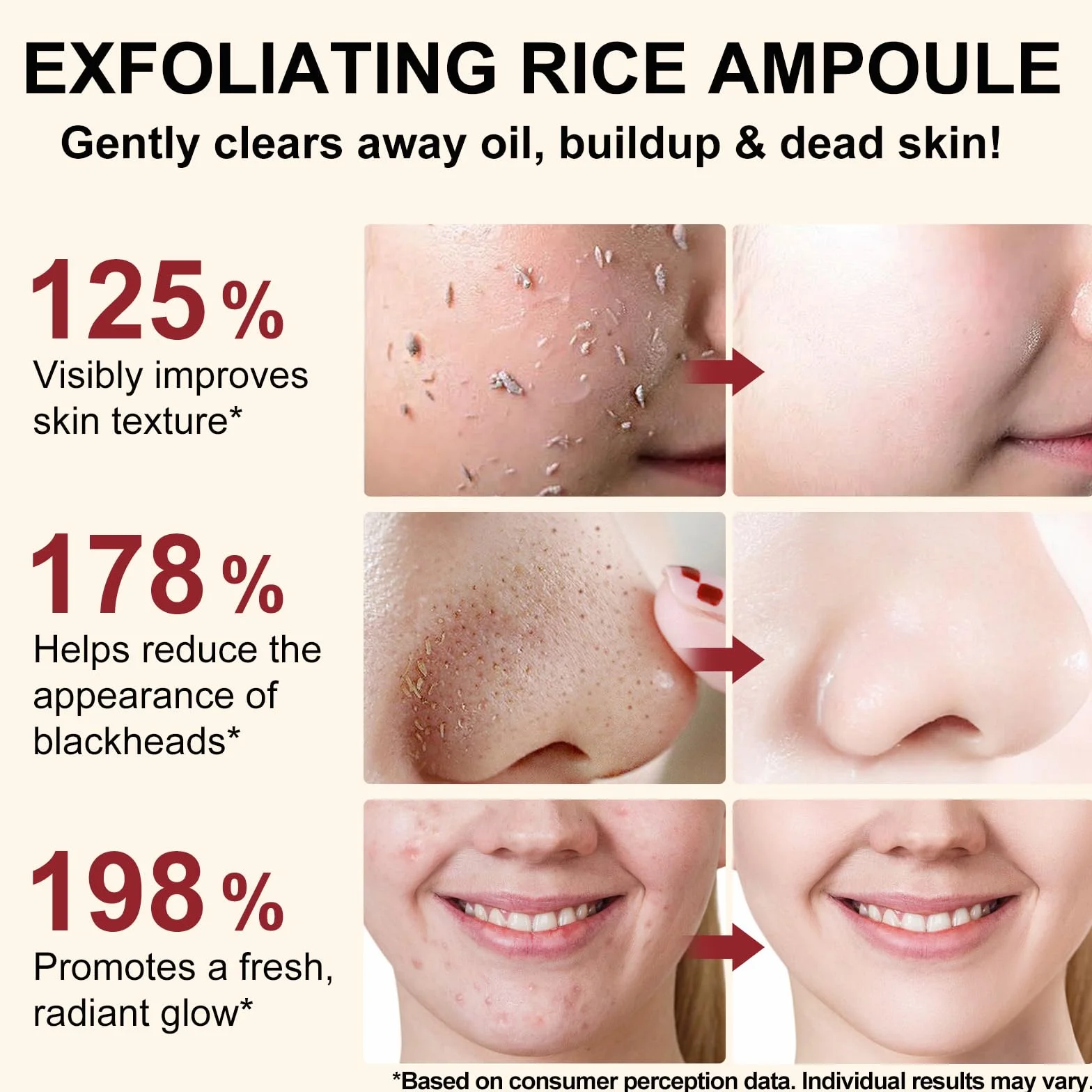 Siero Esfoliante al Riso 100ml, Siero Coreano Esfoliante al Riso, Peeling Viso Delicato,Scrub Viso Anti Punti Neri Rimozione, Riduce Pori, Idratante e Illuminante,Rimuove Cellule Morte,pelli sensibili