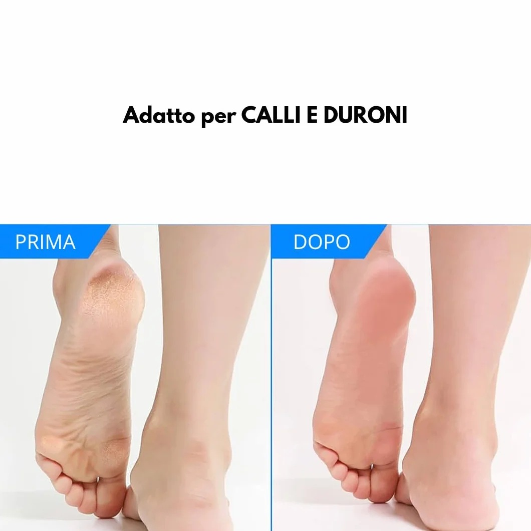 Sgorbie per pedicure professionale 2 pezzi acciaio inox temprato N° 2-4-6-8-10-12