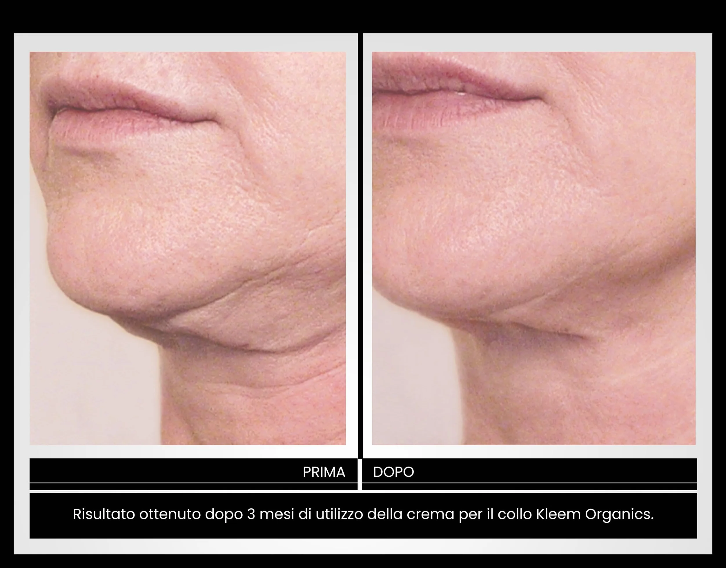 Crema Rassodante Collo e Décolleté Effetto Lifting per Ridurre Rughe, Perdita di Tonicità e Rilassamento Cutaneo - Formula Naturale Approvata da Dermatologi Italiani
