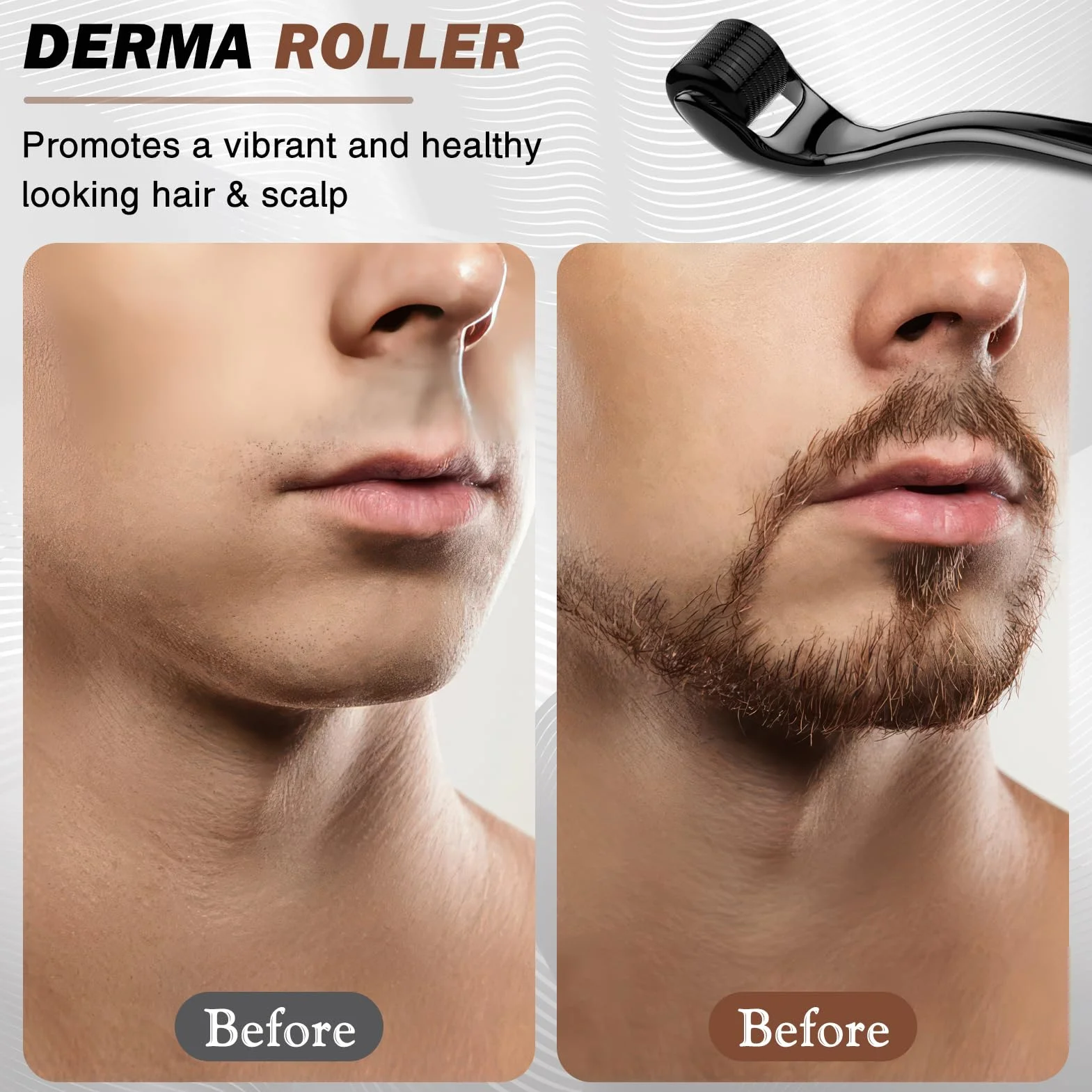 Dermaroller Capelli 540-Aghi Rullo Derma 0,5 mm Nero per Crescita Dei Capelli e Trattamento Perdita Capelli