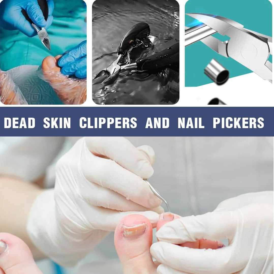 Taglia Cuticole Professionale, Tronchese Per Unghie Spesse Incarnite con Spingi Cuticole,Tronchese Unghie, Tronchesino Tagliaunghie Professinale, per Unghie Spesse e Dure Pedicure e Manicure Strumenti