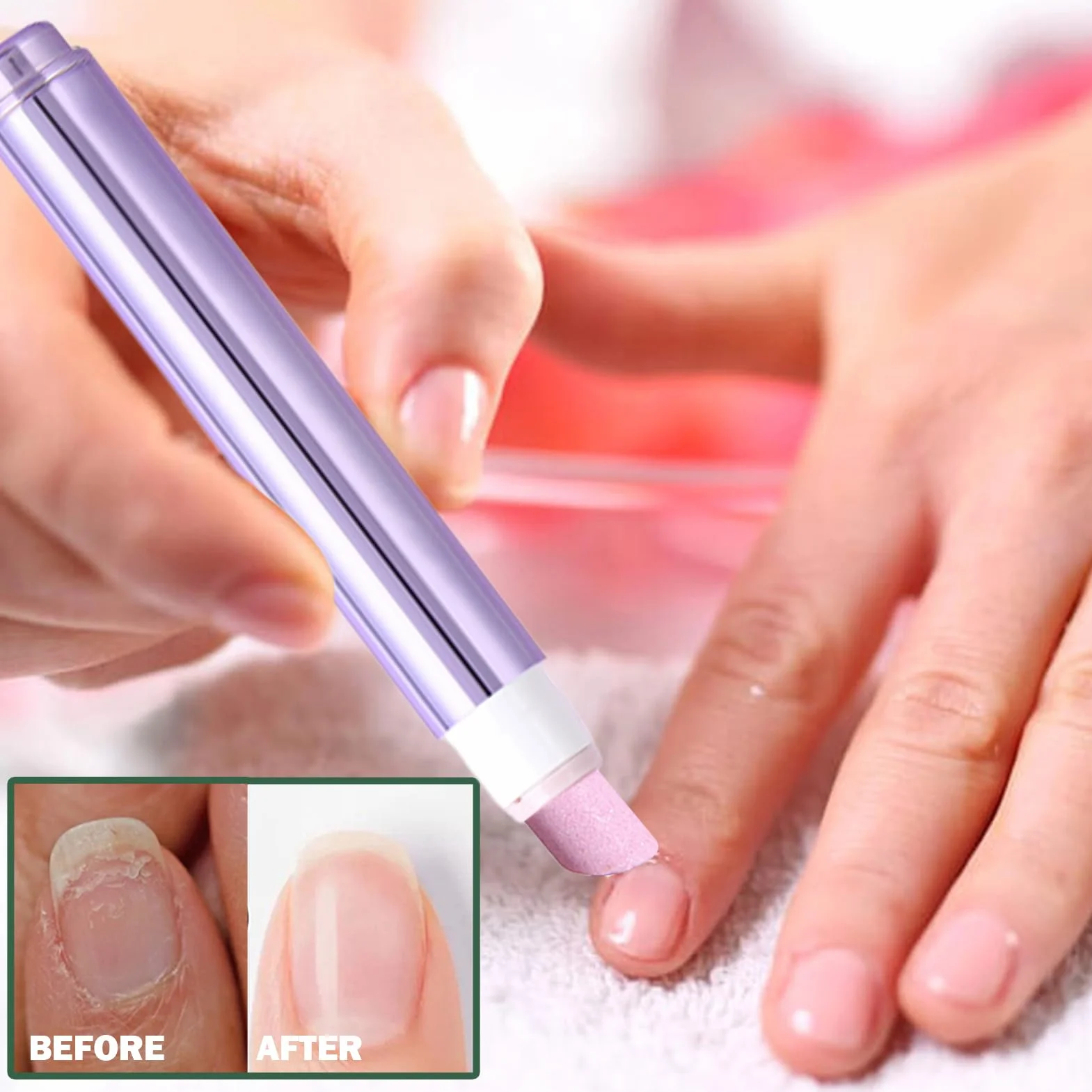 Penna per Cures unghie 3 in 1 | Penna 'olio per cuticole per unghie | Penne liquide per rimozione cuticole con corpo girevole | Cuticoles Remover Repair Penne per ipotizzati