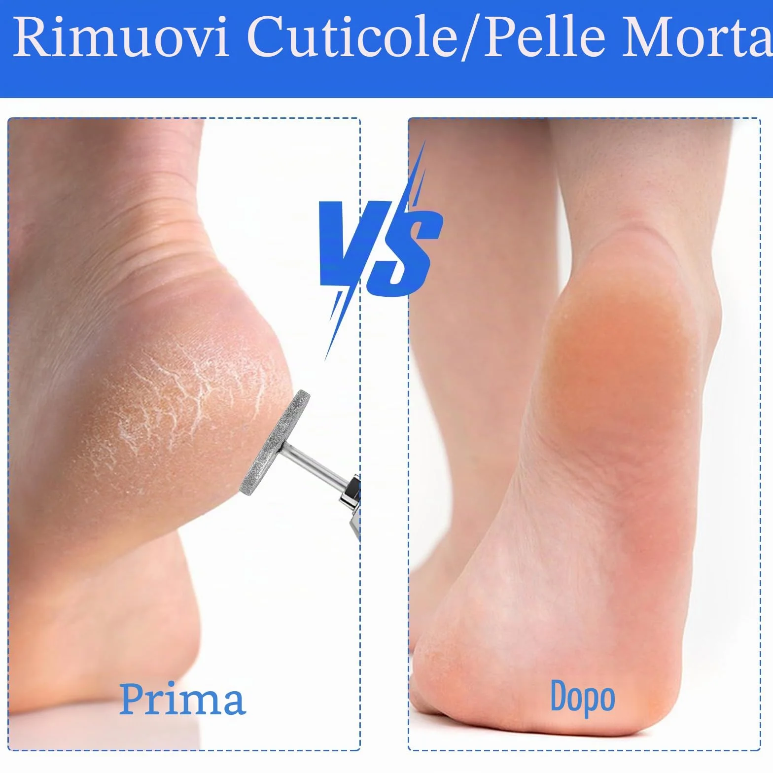 Punte per fresa per unghie, 2 pezzi, disco abrasivo 20 mm, per pedicure in gel acrilico