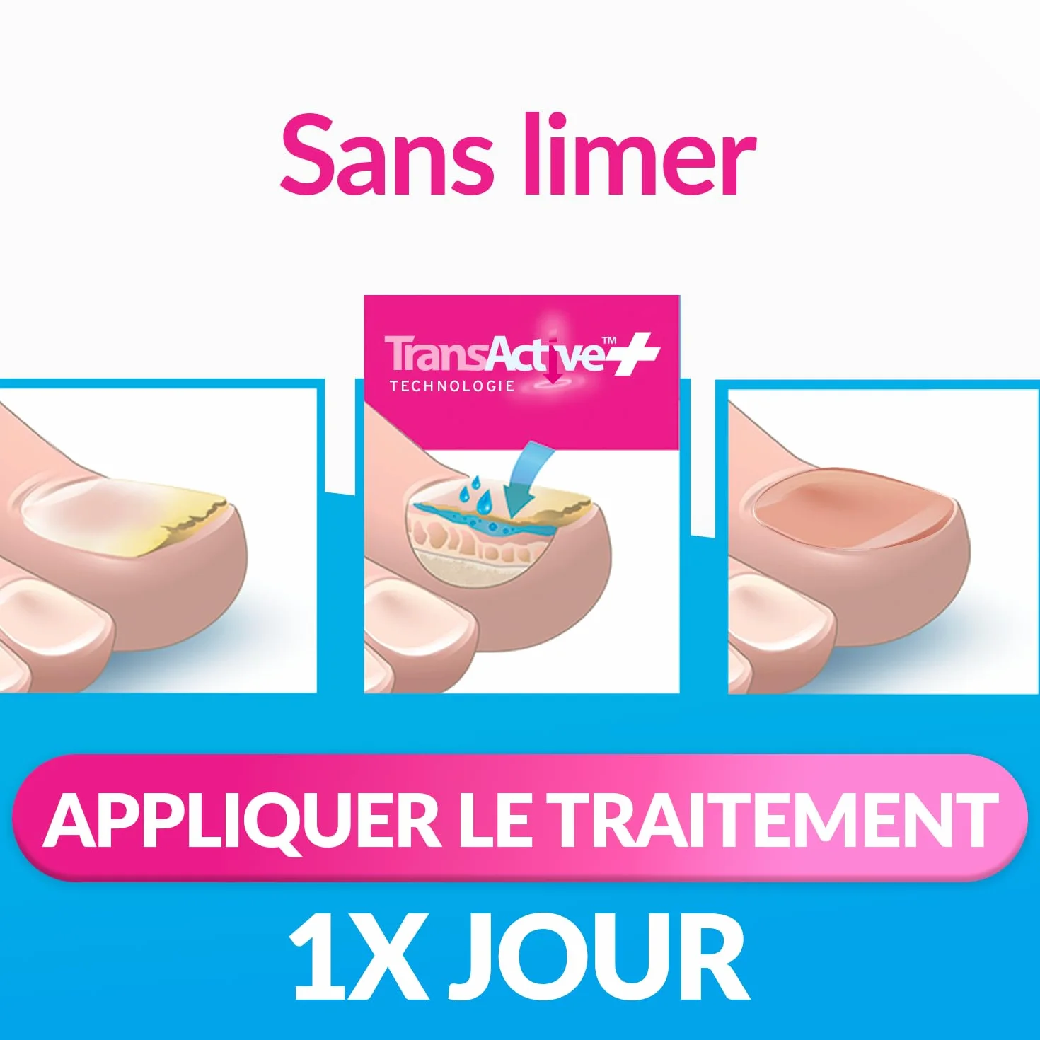 EXCILOR - Forte Color - Trattamento della micosi dell'unghia - Tratta e copre - Trattamento 30 ml + Smalto cosmetico per unghie da 8 ml - Clinicamente provato* - Nude