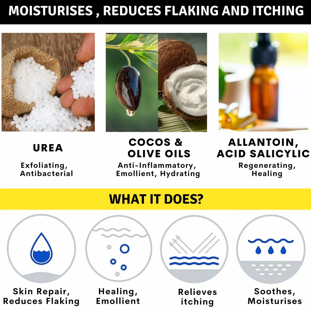 Crema Urea 20%, Eczemi, Cheratosi, Psoriasi, Eruzioni Cutanee, Riduce il Prurito, Sechezza, Pelle Secca e Screpolata, Calli, Duroni, Desquamazioni,- Cocos e Olio d'Oliva, 50g
