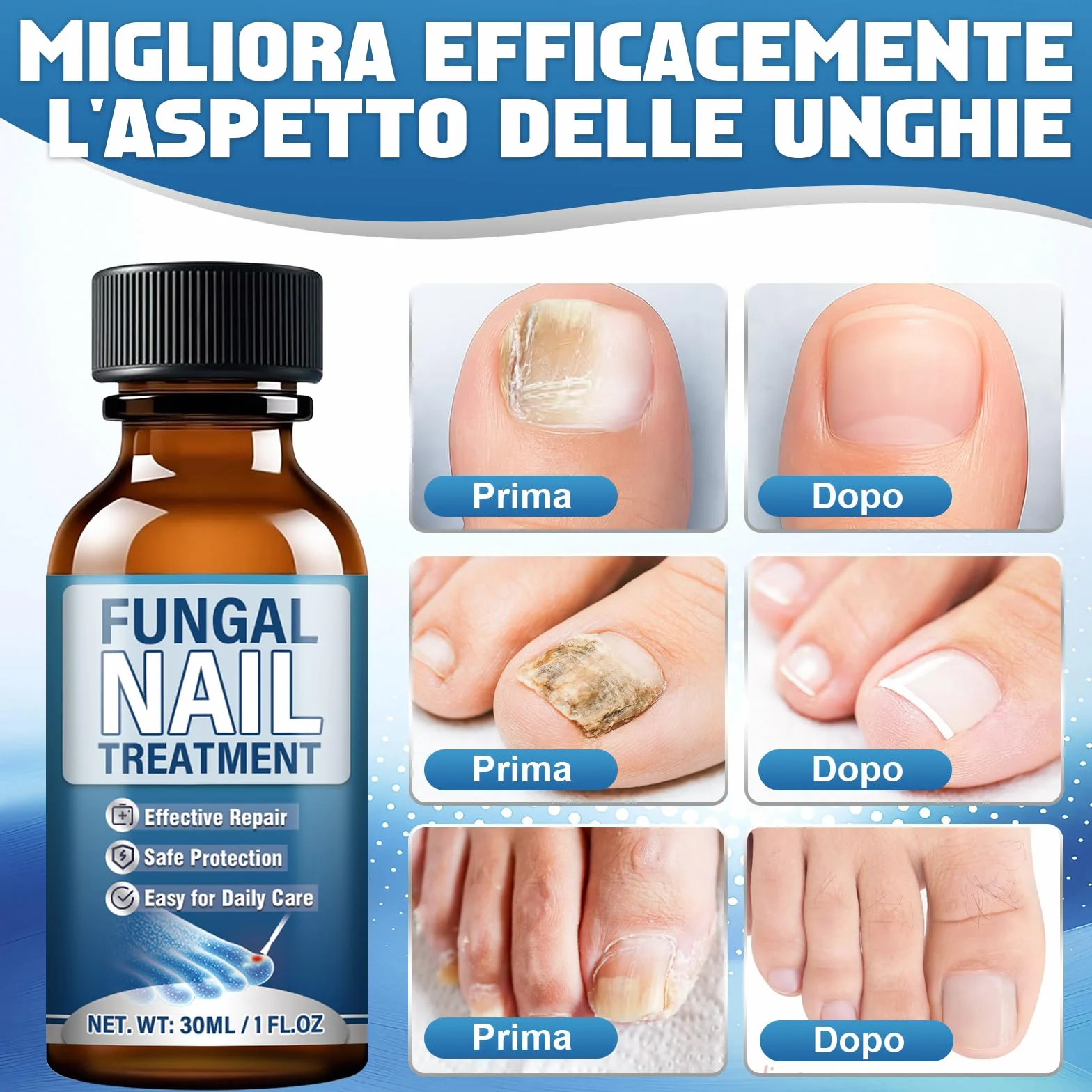 Micosi Unghie Piede, 30ml Liquido Antimicotico per Funghi Unghie Piedi con Pennello e Lima