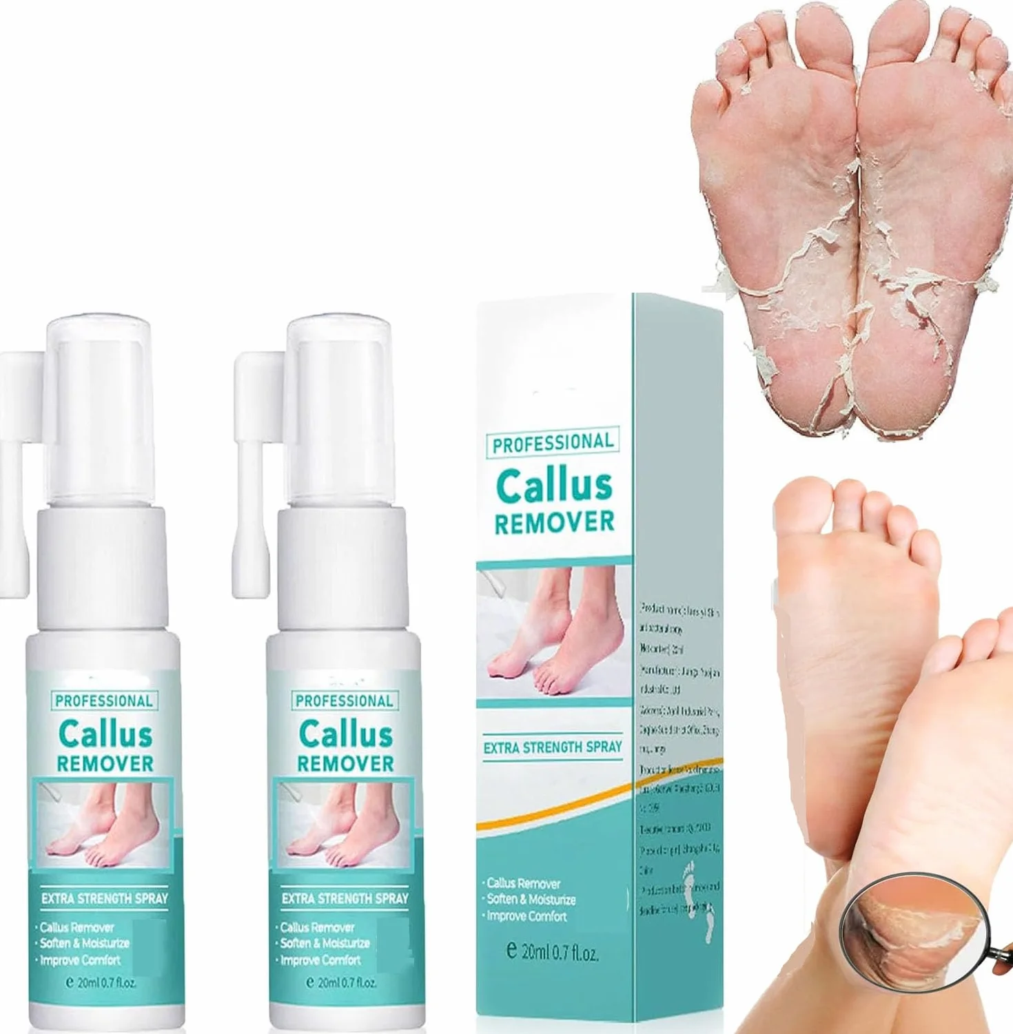 Spray extra forte per rimuovere i calli: spray rimuovi calli per piedi e tallone, olio spray per pelle morta
