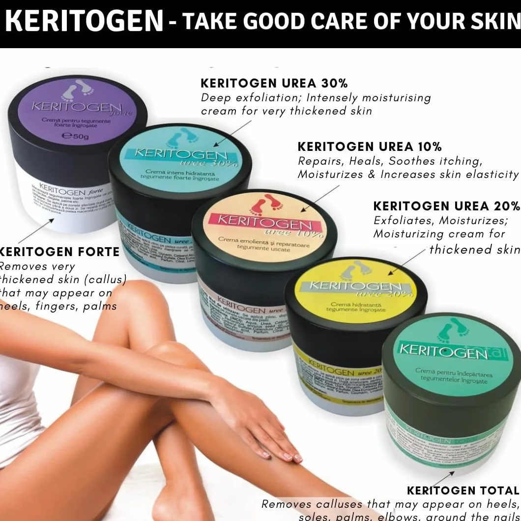 Crema Urea 20%, Eczemi, Cheratosi, Psoriasi, Eruzioni Cutanee, Riduce il Prurito, Sechezza, Pelle Secca e Screpolata, Calli, Duroni, Desquamazioni,- Cocos e Olio d'Oliva, 50g