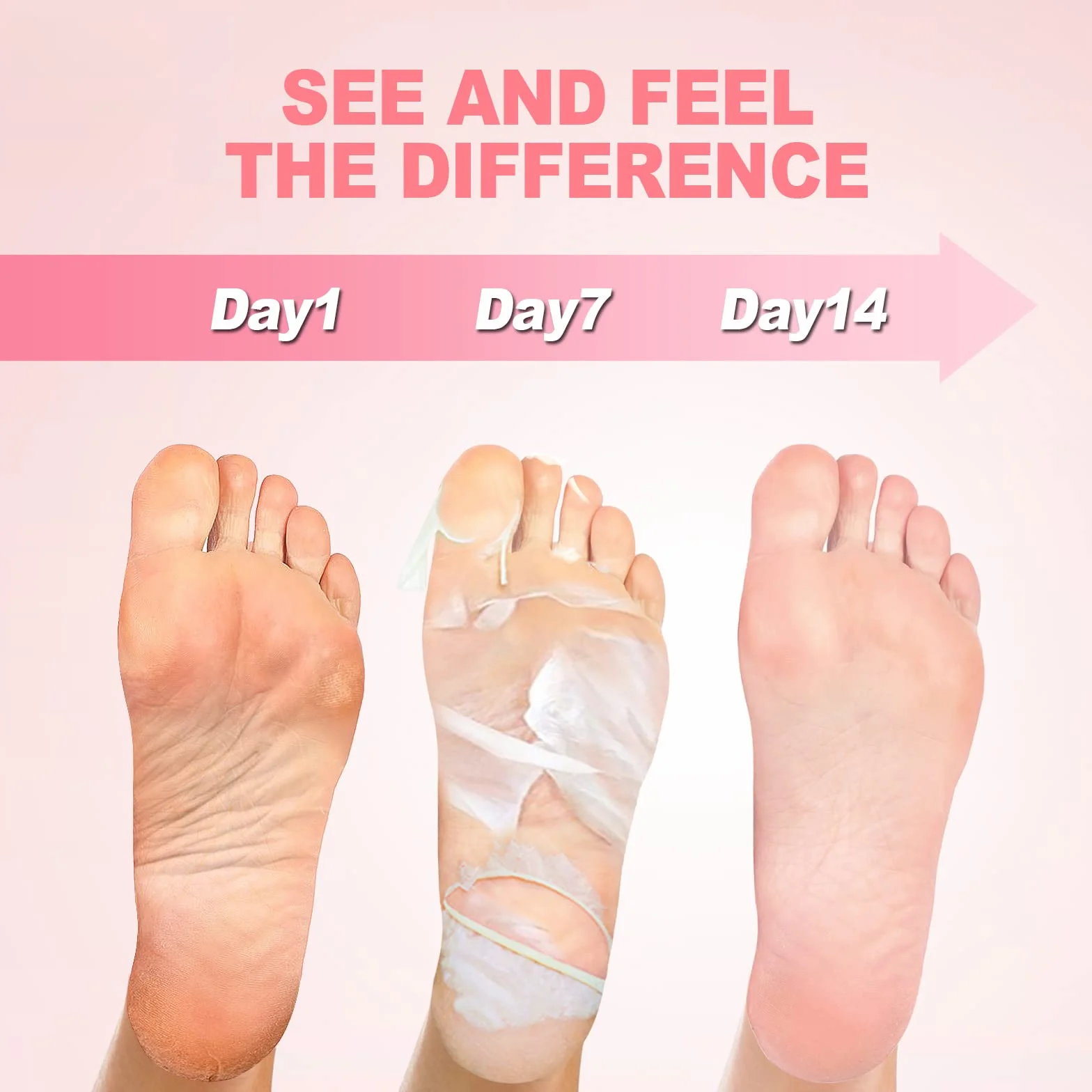 Maschera Esfoliante Piedi, 3 paia JVR Acido Lattico Maschera Peeling Piedi, riparazione tallone ruvido, rimozione della pelle morta, desquamazione di calli (Rosa)