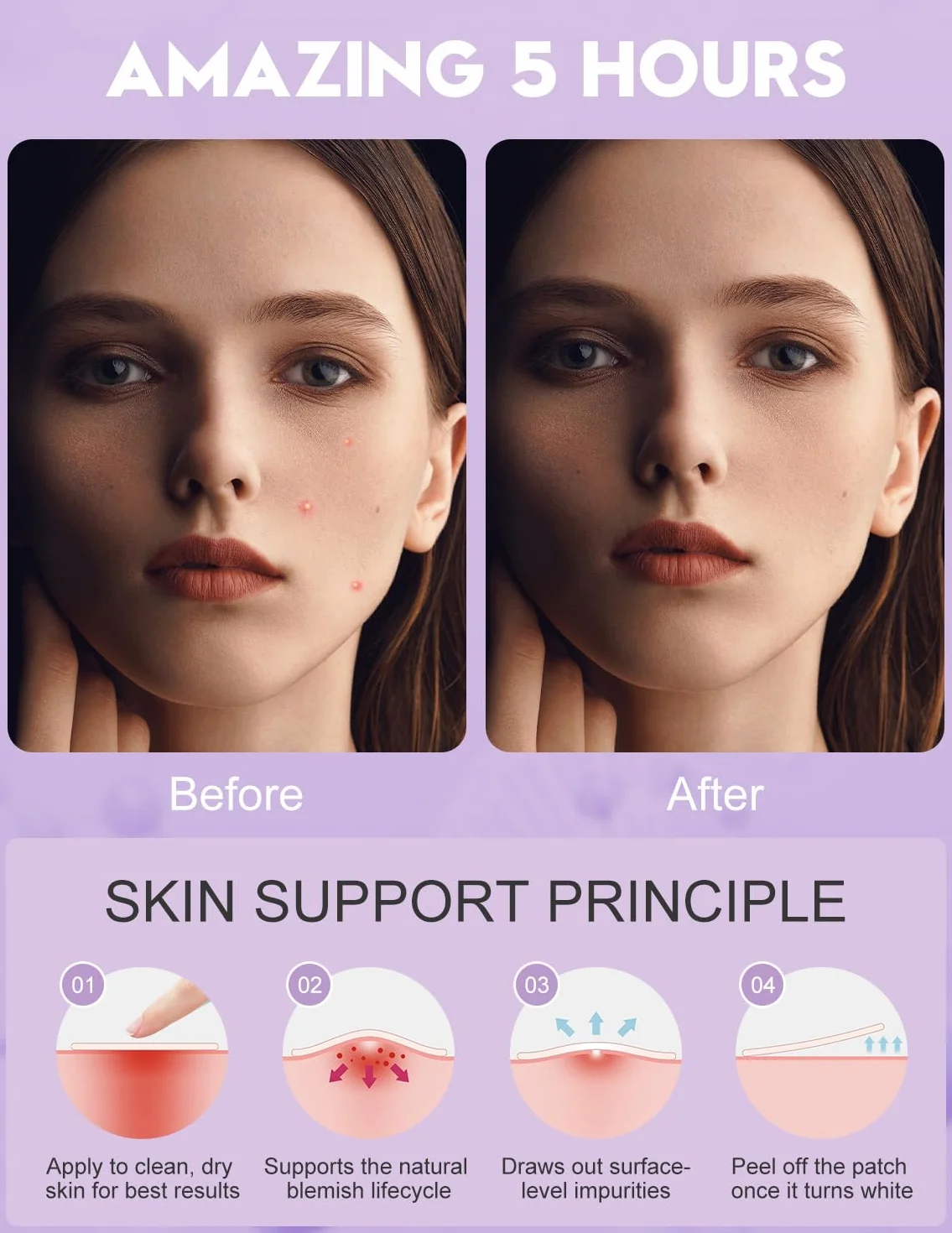Patch Brufoli, Pimple Patch, 108 Patch Trasparenti (5 Misure 8/10/12/14/16 mm), Hydrocolloid Viso Acne Patch, con Centella, Tea Tree & Acido Salicilico — Minimo, Impermeabili, Assorbono Secrezioni