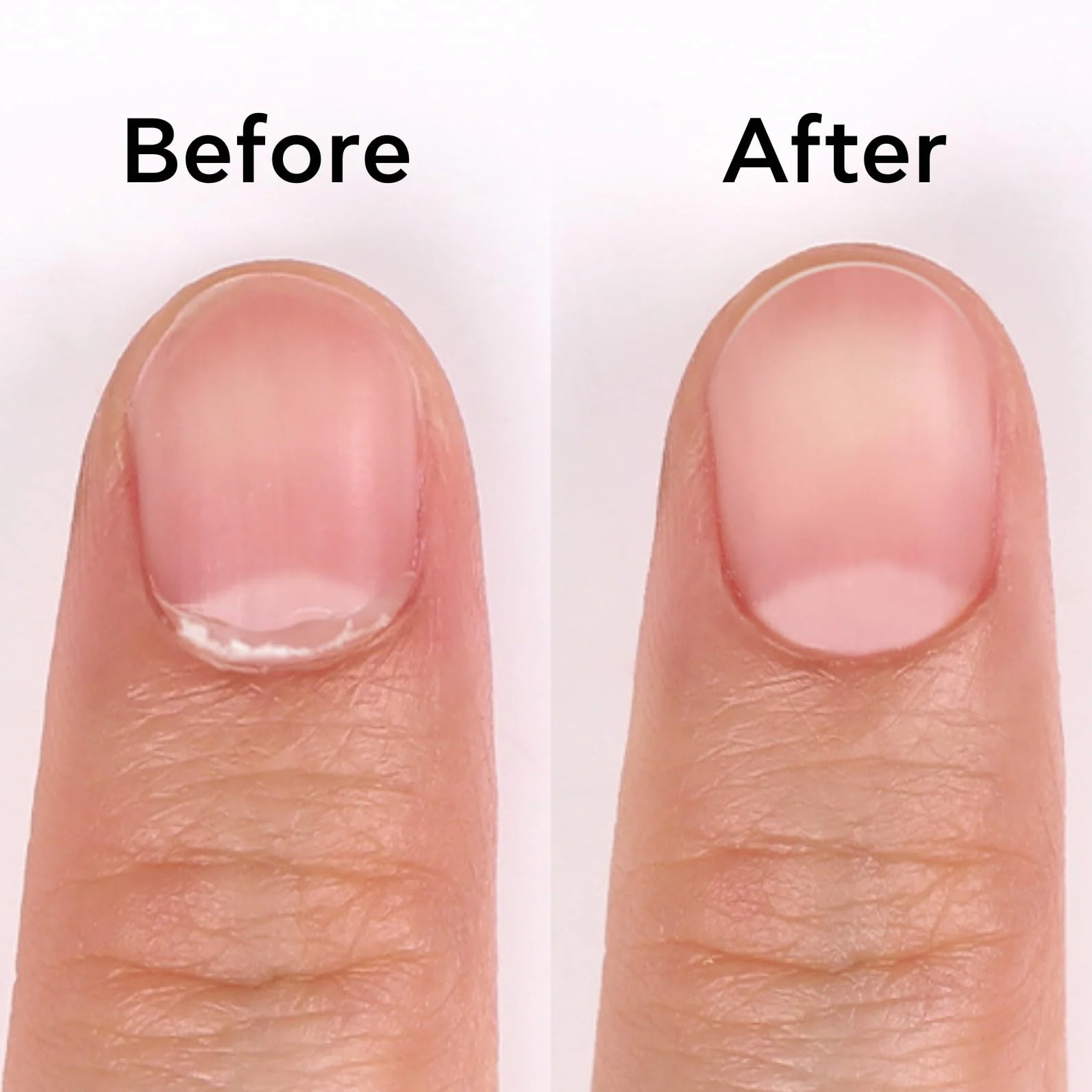 Bluesky Solvente per Cuticole 30g, Acido Ialuronico e Camomilla, Ammorbidente Pelle Morta ad Azione Rapida 15 Secondi per Preparazione Manicure Gel e Acrilico