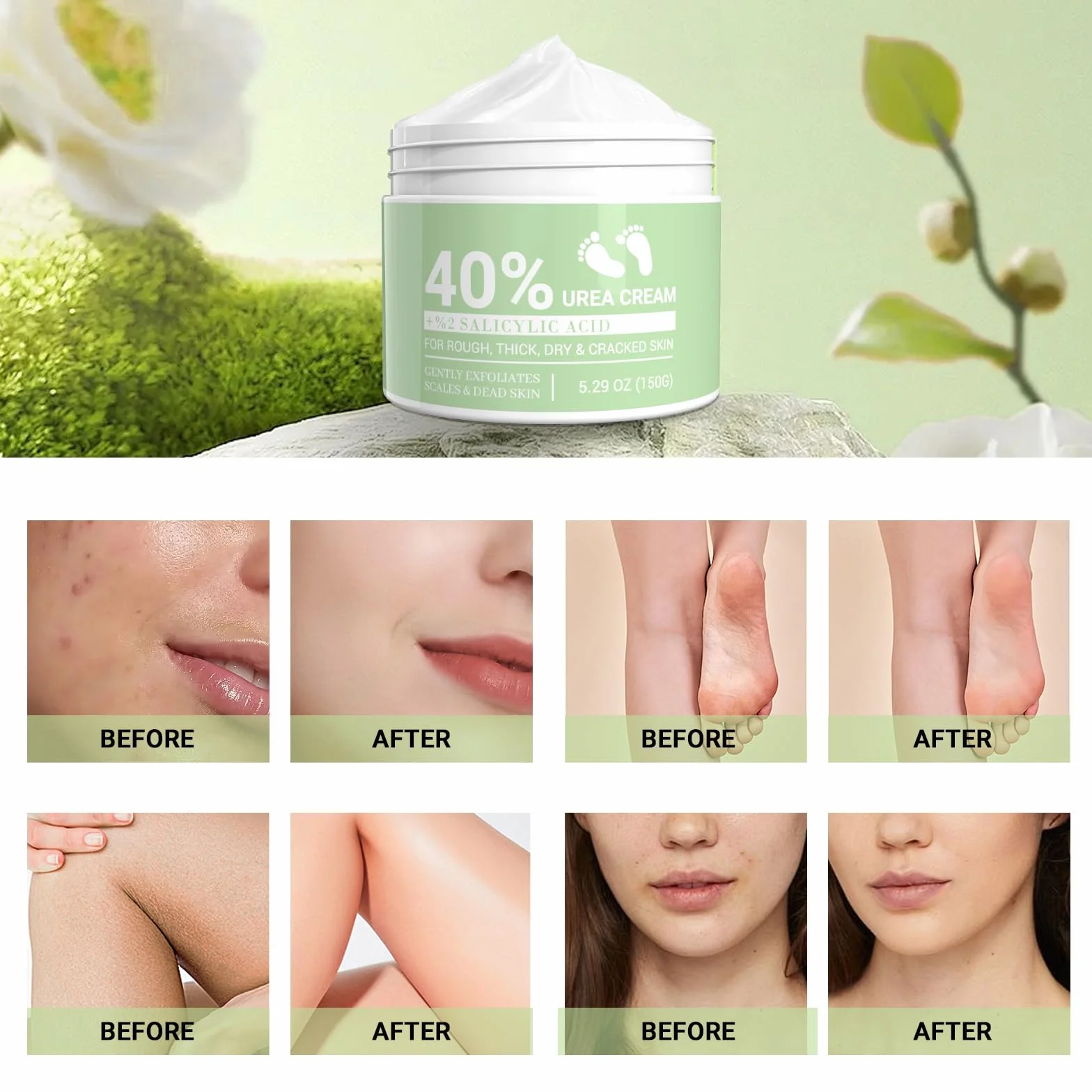 Crema Urea 40% con Acido Salicilico 2% e Aloe Vera per Piedi Secchi Sscrepolati