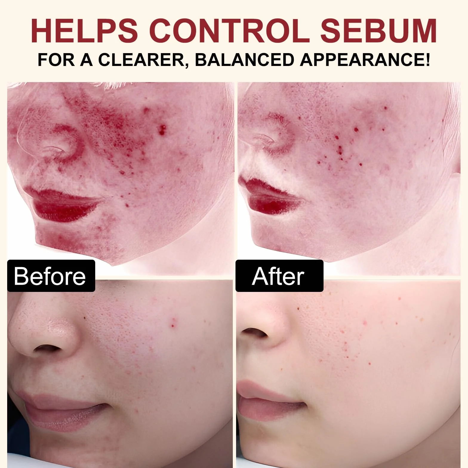 Siero Esfoliante al Riso 100ml, Siero Coreano Esfoliante al Riso, Peeling Viso Delicato,Scrub Viso Anti Punti Neri Rimozione, Riduce Pori, Idratante e Illuminante,Rimuove Cellule Morte,pelli sensibili