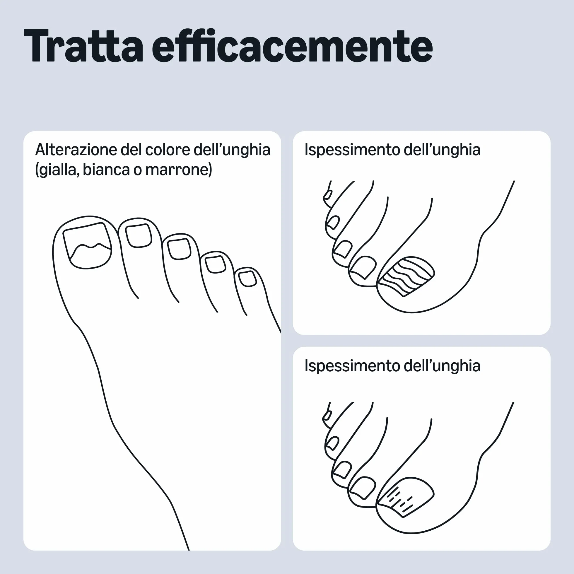 Healthcare by Amazon Liquido per il Trattamento delle Unghie Fungine, 10ml (in Precedenza Amazon Basic Care) - L'Imballaggio Può Variare