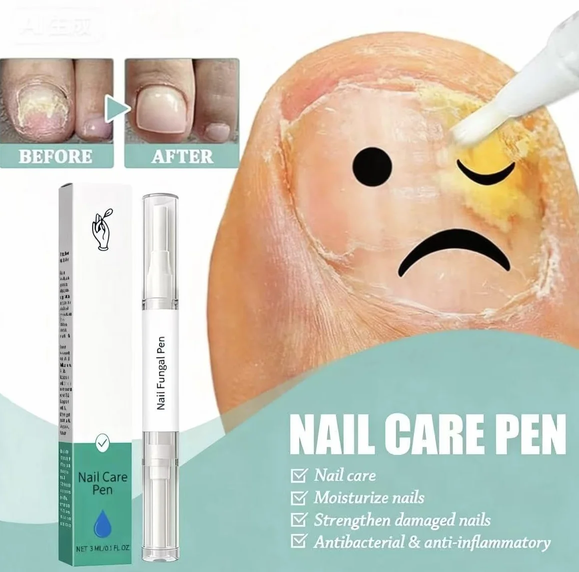 Anti Fungal Pen