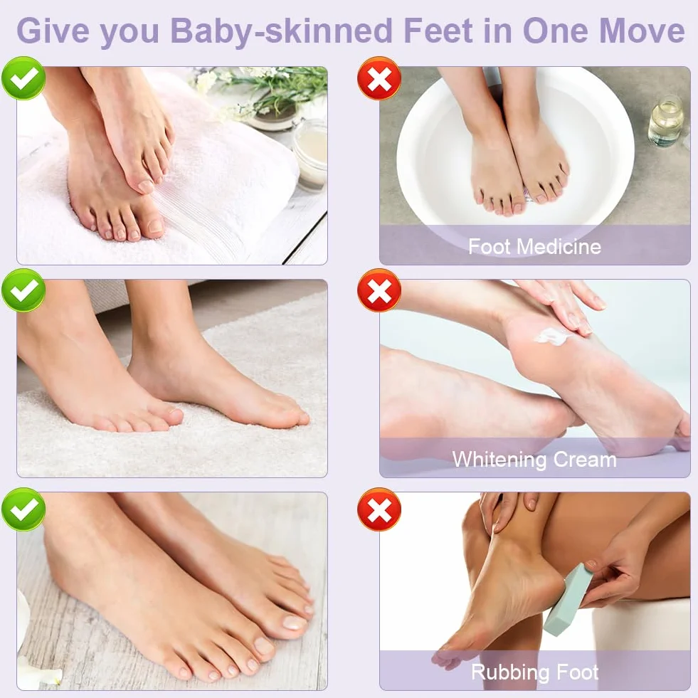 ACWOO Maschera Piedi Esfoliante, 4 paia Maschera Peeling Piedi， Maschera per Piedi Efficace Cura dei Piedi i Scrub Piedi, Maschera Esfoliante Rimozione calli e Pelle Morta piedi
