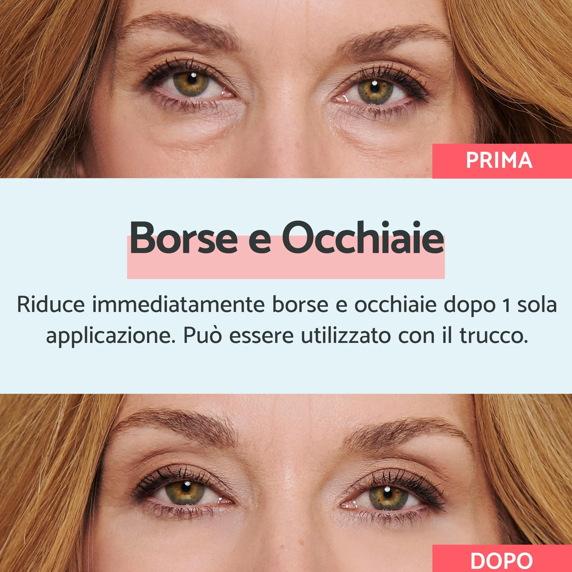 Remescar Crema Borse e Occhiaie 8ml – Trattamento Istantaneo Contorno Occhi – Crema Defaticante Uomo Donna con 180 Applicazioni