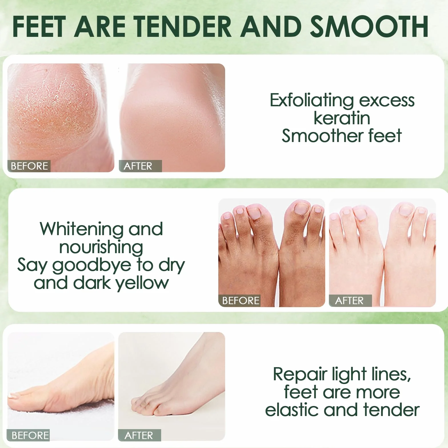 2 Paia Maschera Piedi Esfoliante, Rimuove Pelle Morta Ripara Talloni, Maschera idratante i piedi una pelle liscia per uomini e donne (Aloe Vera + Avocado)