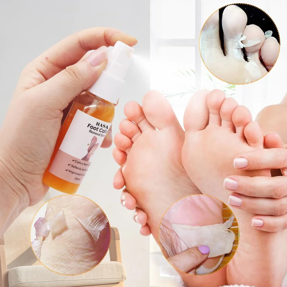 Spray per la Rimozione del Callo del Piede, Spray per il Peeling del Piede, Spray per Rimuovere i Calli dei Piedi,per Talloni Ruvidi e Screpolati, Pelle Secca e Calli