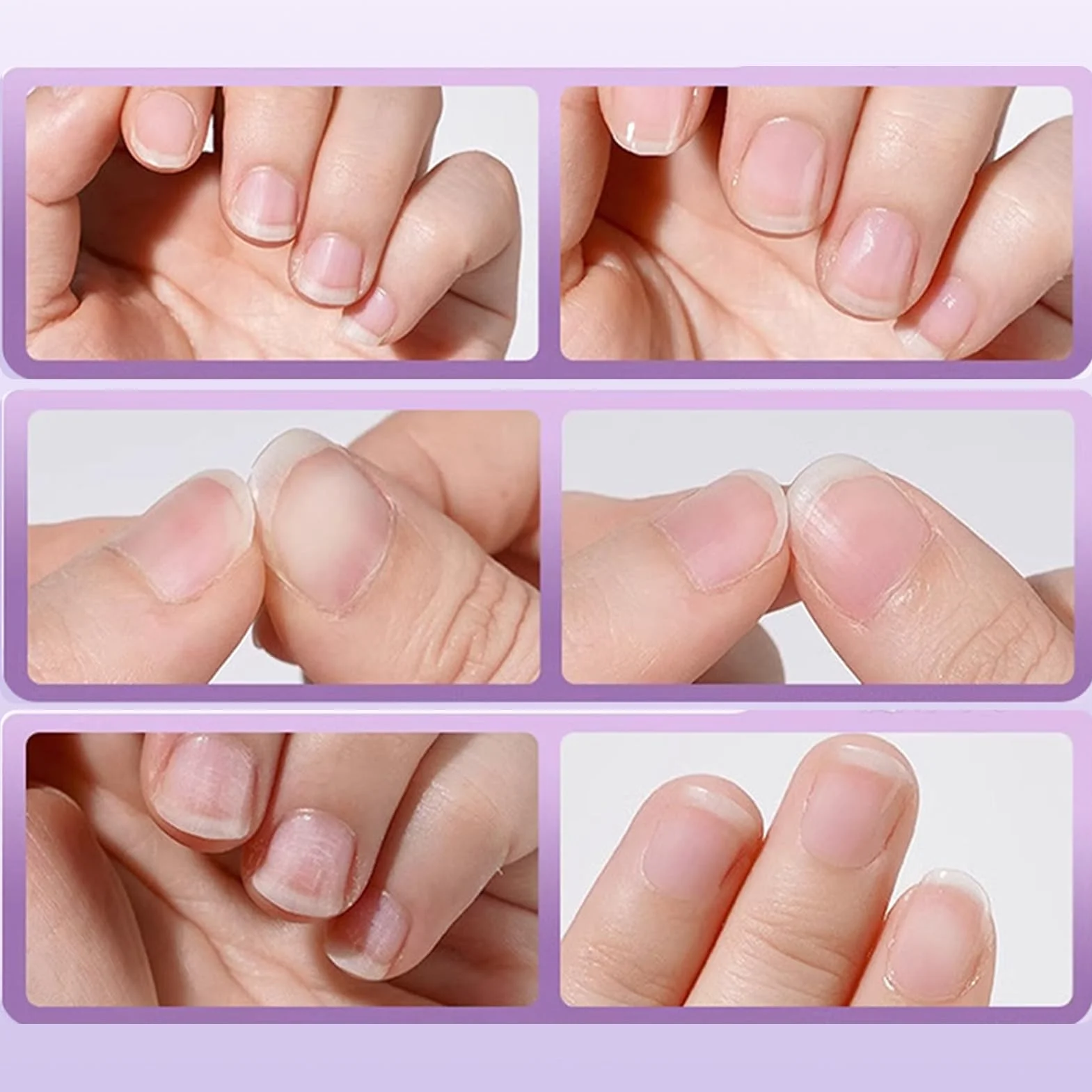 Penna per Cures unghie 3 in 1 | Penna 'olio per cuticole per unghie | Penne liquide per rimozione cuticole con corpo girevole | Cuticoles Remover Repair Penne per ipotizzati
