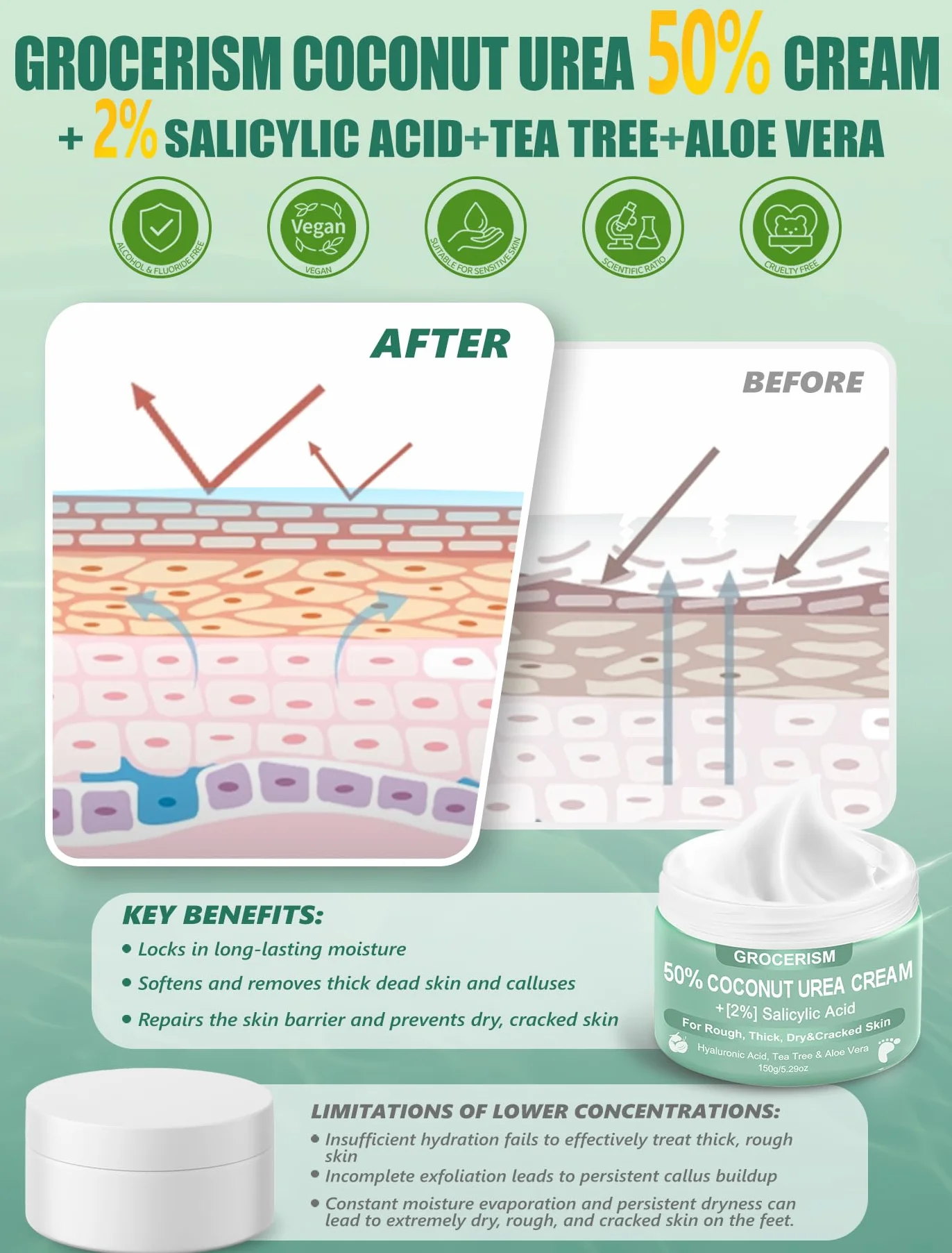 Crema Urea 50% per piedi Spessore massimo 150 grammi con cocco e 2% acido salicilico, crema piedi e mani con acido ialuronico, tea tree e aloe vera per umidificazione profonda, calli
