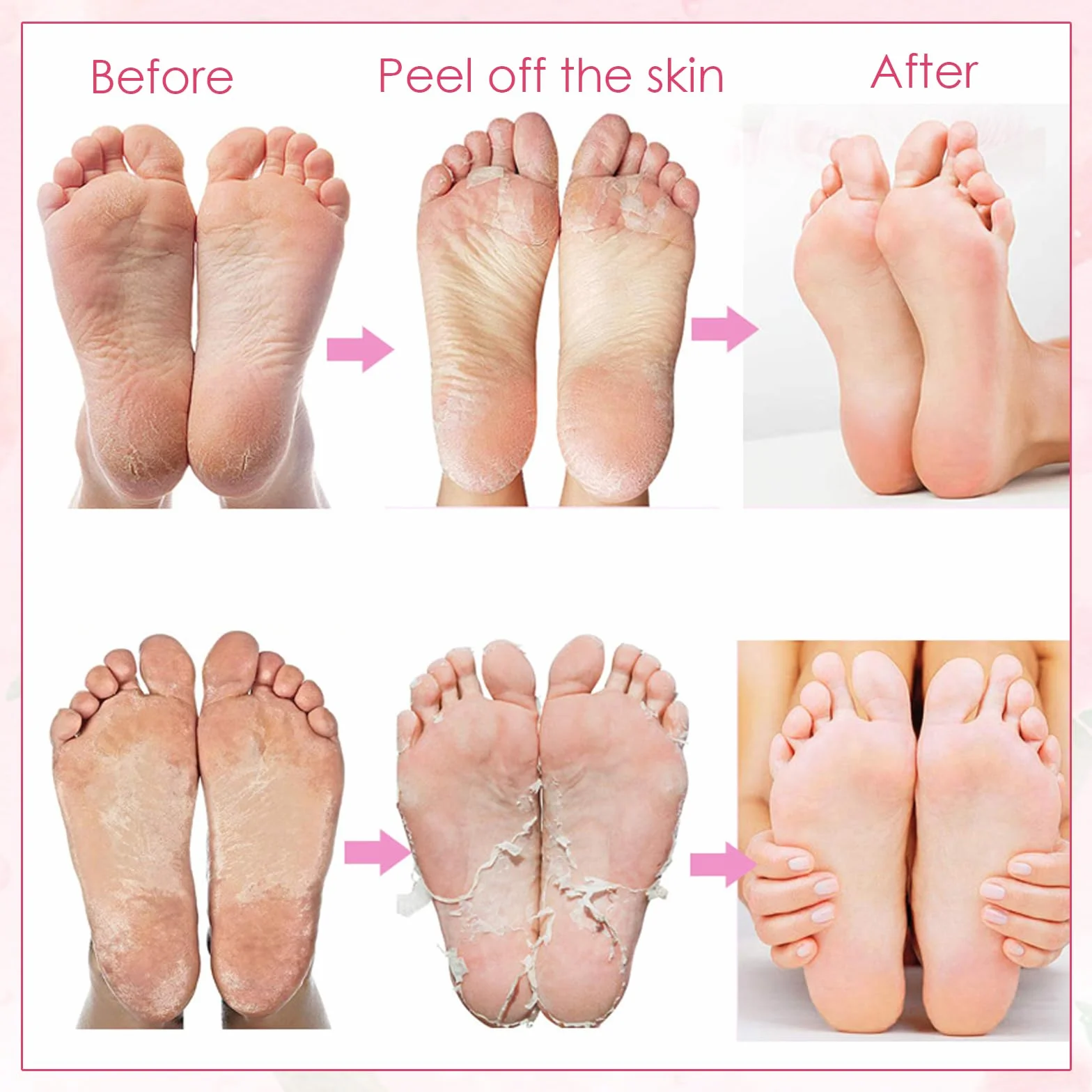 Maschera per i piedi Confezione da 2 calzini per calli, calzini per rimozione calli pesca, ripara i talloni e rimuove i calli dei piedi secchi e morti Maschera per i piedi Maschera peeling