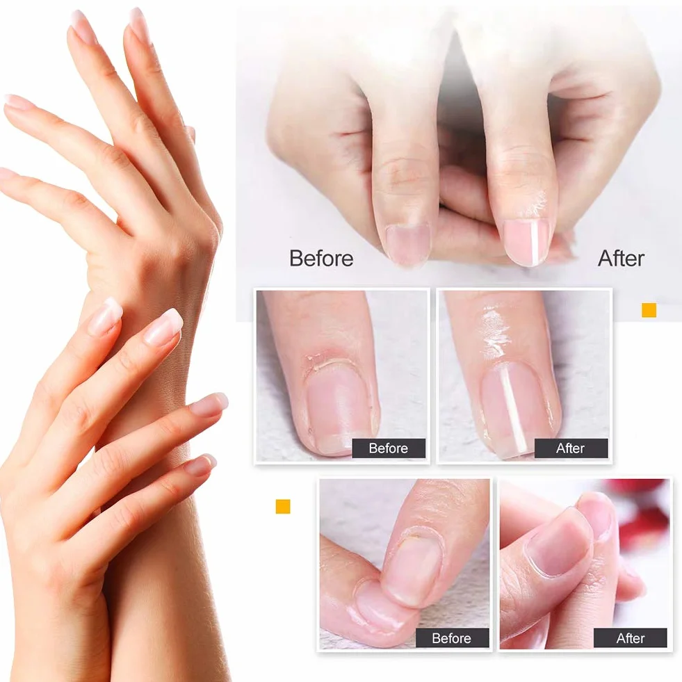 Trattamento Cuticole, Olio per cuticole, Siero trattamento unghie, Olio per cuticole penna Trattamento Olio per Cuticole Riparare la Cuticola Incrinata e Secca, 4 Pezzi
