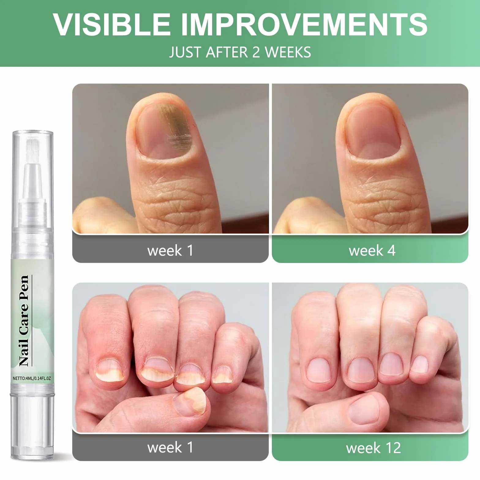 Nail Care Pen - Set di 3 penne per unghie curate e unghie dei piedi con olio di tea tree, vitamina E e aloe vera