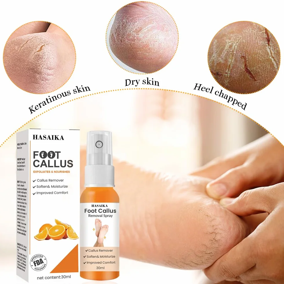 Spray per la Rimozione del Callo del Piede, Spray per il Peeling del Piede, Spray per Rimuovere i Calli dei Piedi,per Talloni Ruvidi e Screpolati, Pelle Secca e Calli