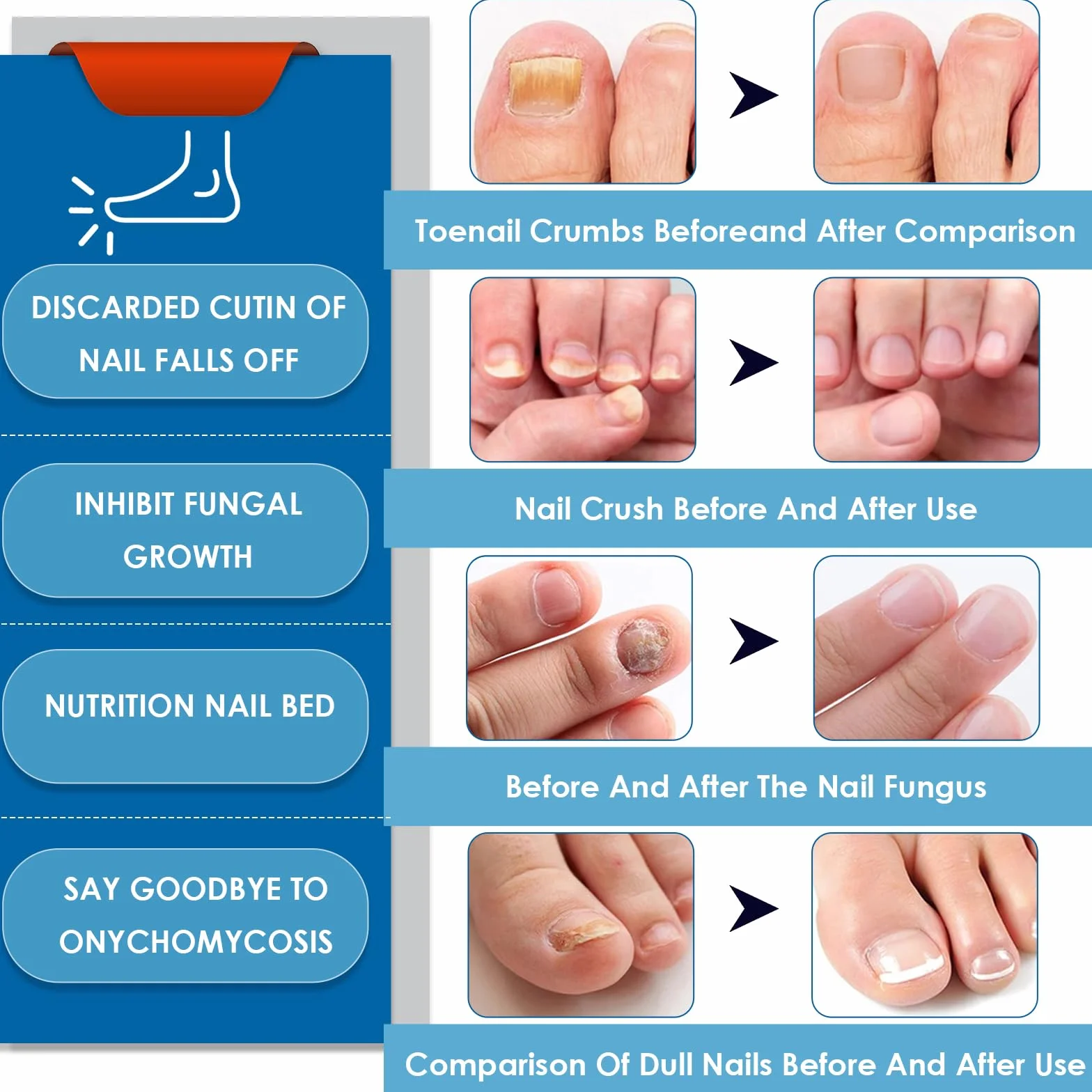 4 Pezzi Penna per la Cura Delle Unghie, Routine Nail Care Pen, Dell'unghia Nutre e Lenisce Le Unghim, Migliora l'aspetto Dell'unghia, Favorisce la Salute Delle Unghim