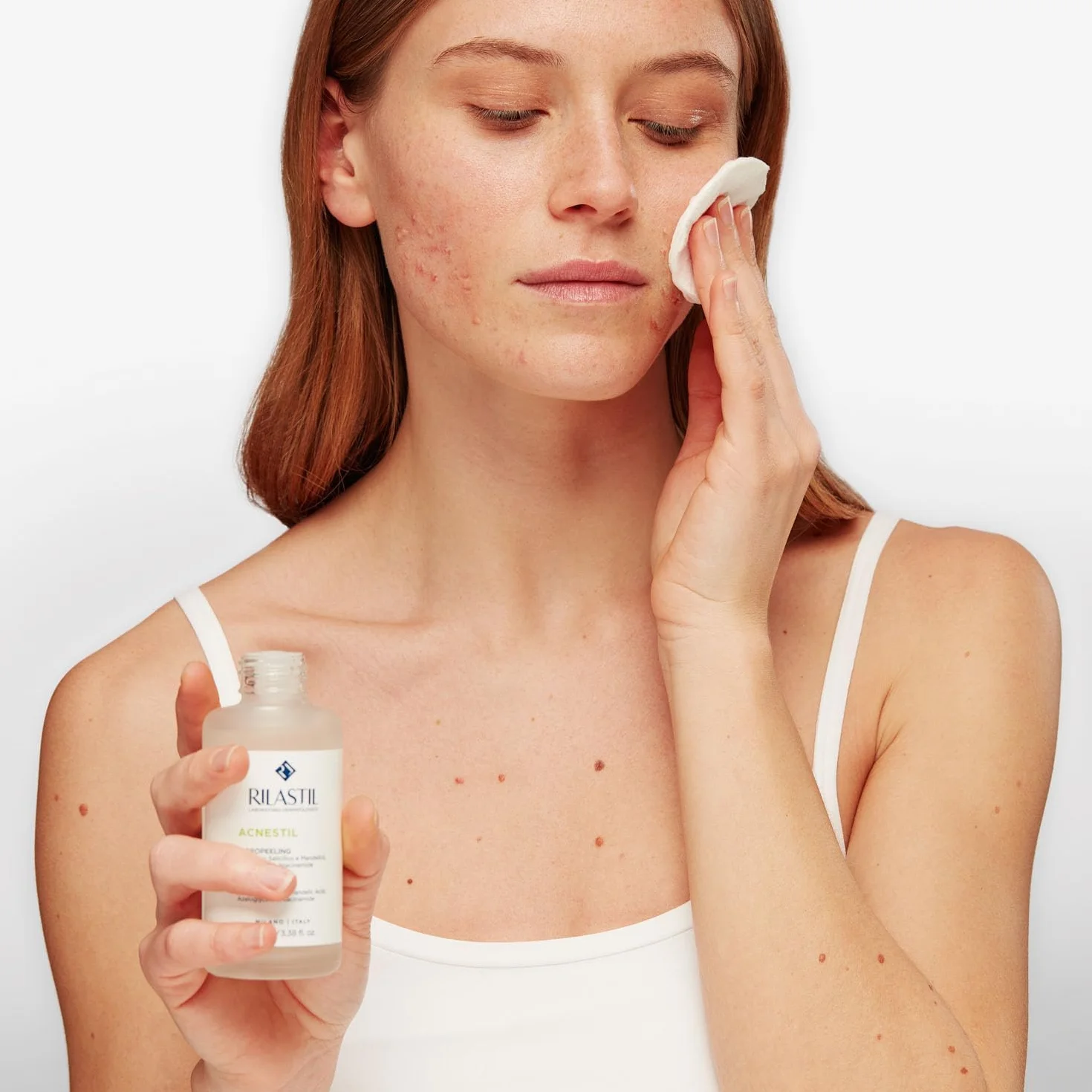 Rilastil Acnestil Micropeeling, Peeling Intensivo Viso con Acido Salicilico, Lozione Esfoliante Antimperfezioni e Purificante, per Pelli Impure con Tendenza Acneica, Confezione da 100 ml