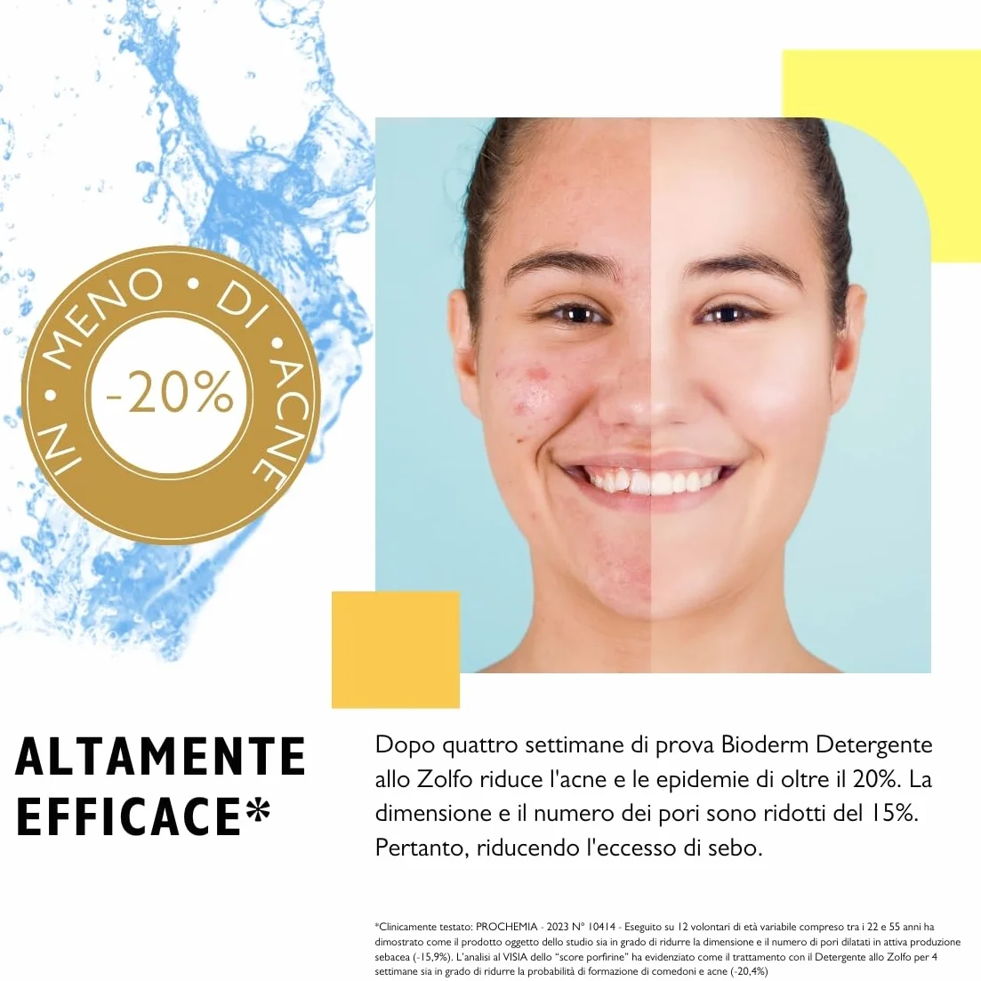 Bioderm S Detergente allo Zolfo 1,5% – Detergente Viso e Corpo per Pelle Grassa e Impura, Acne e Punti Neri – Azione Purificante e Sebo-Normalizzante – 300 ml con Erogatore