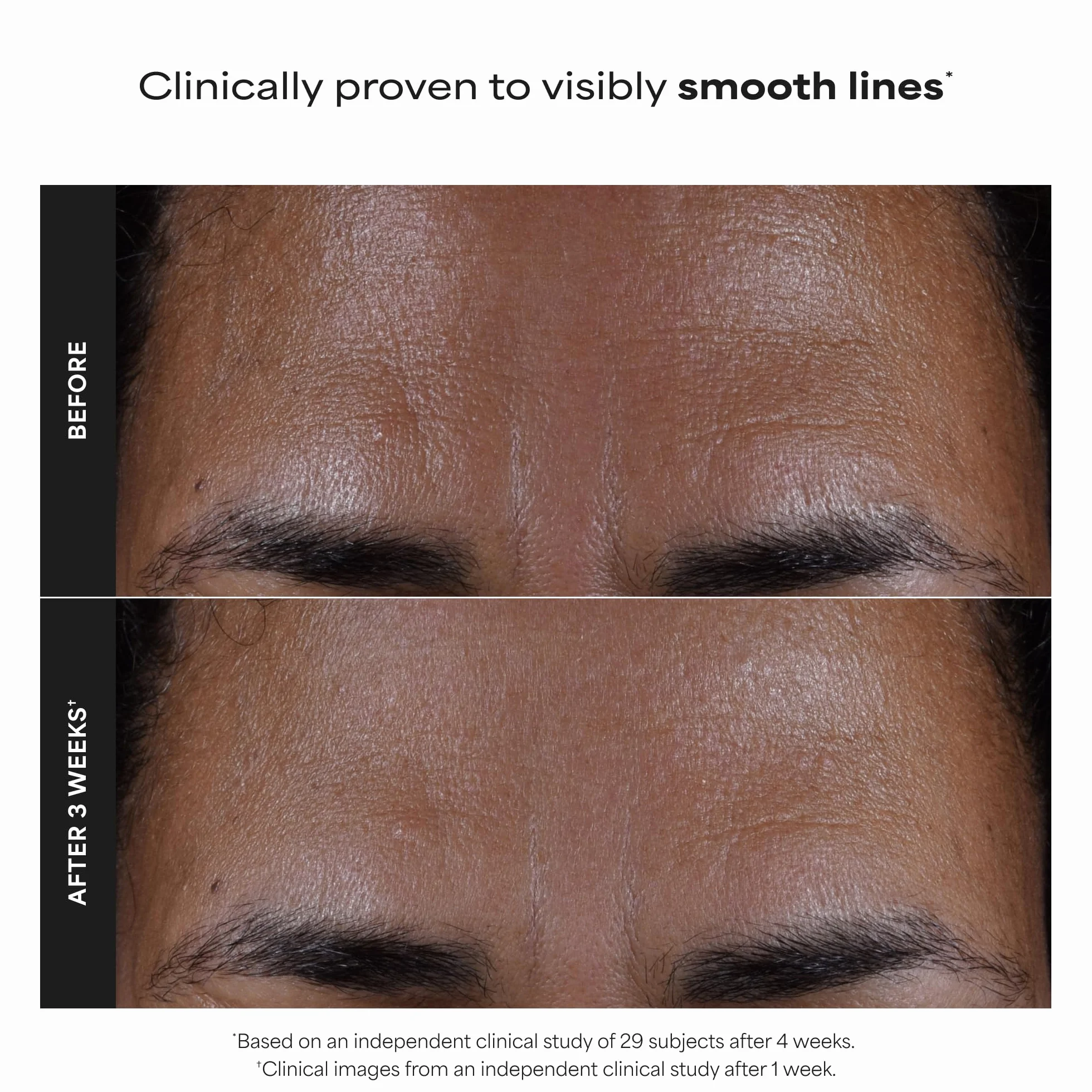 Paula's Choice SKIN PERFECTING 2% BHA Esfoliante Liquido - Peeling Viso con Acido Salicilico - Combatte Imperfezioni, Punti Neri & Brufoli - Ridurre i Pori - Pelli Miste o Grasse - 30 ml
