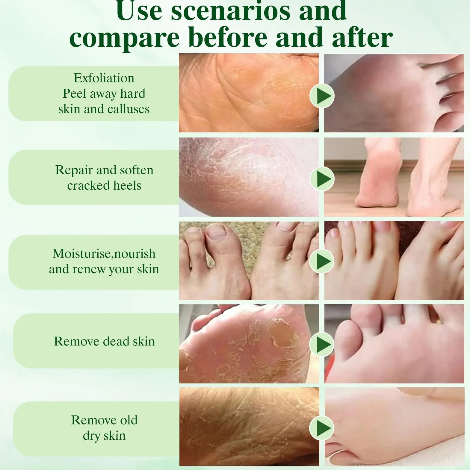 6 paia Maschera Esfoliante Piedi,Peeling Piedi,Idratante,Secchi e Screpolati,con Kit Pedicure per Uomo e Donna,Aloe Vera